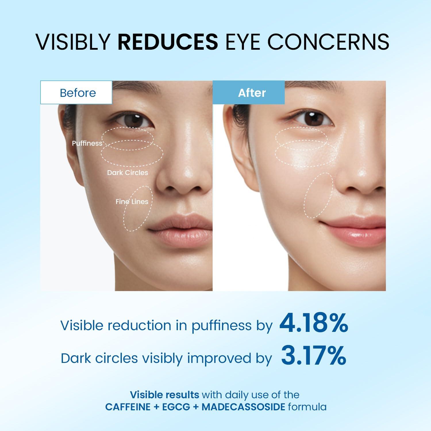 Crema para Ojos Dongyu 15 ml con Cafeína - Anti-Ojeras