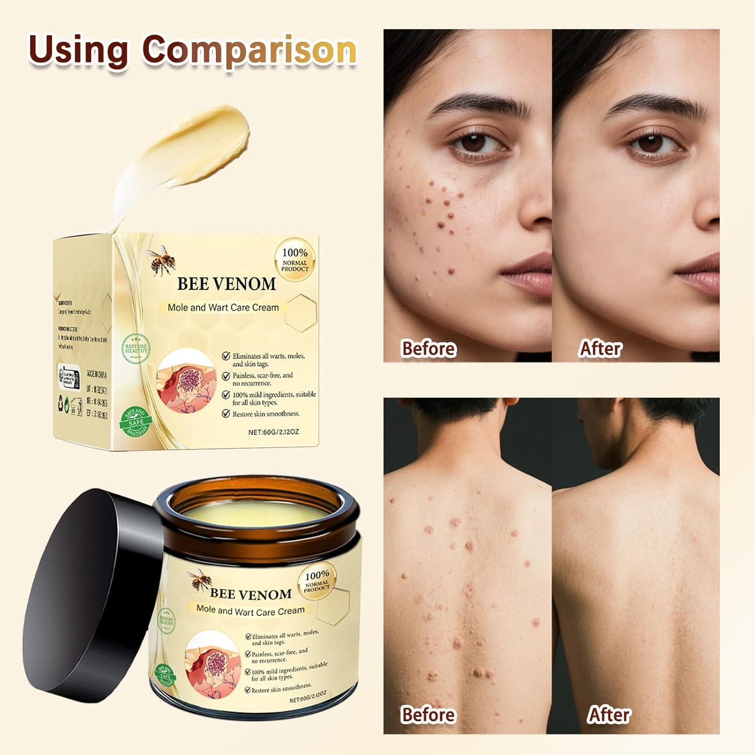 Crema Hidratante de Veneno de Abeja ZANGLEX 2 Pcs 60g