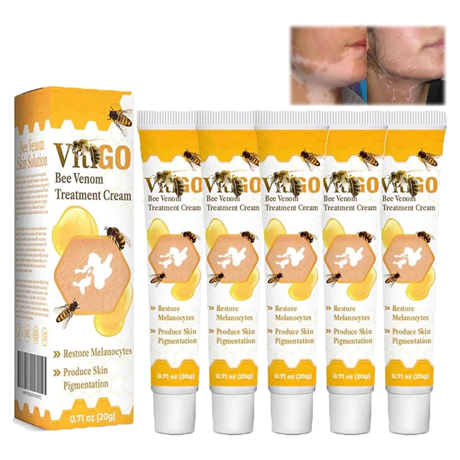 Crema Tratamiento Veneno de Abeja Vitiligo NYYQYYN 5 Piezas