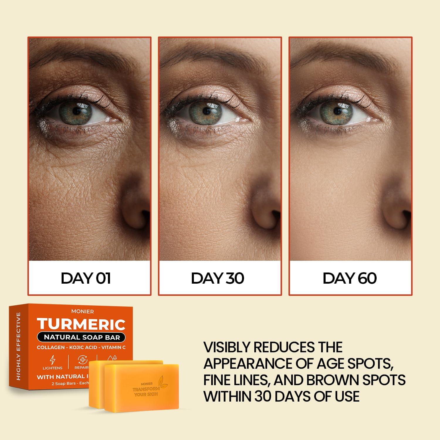 Jabón de Cúrcuma MONIER para Manchas Oscuras - Vegano 2 Pzas