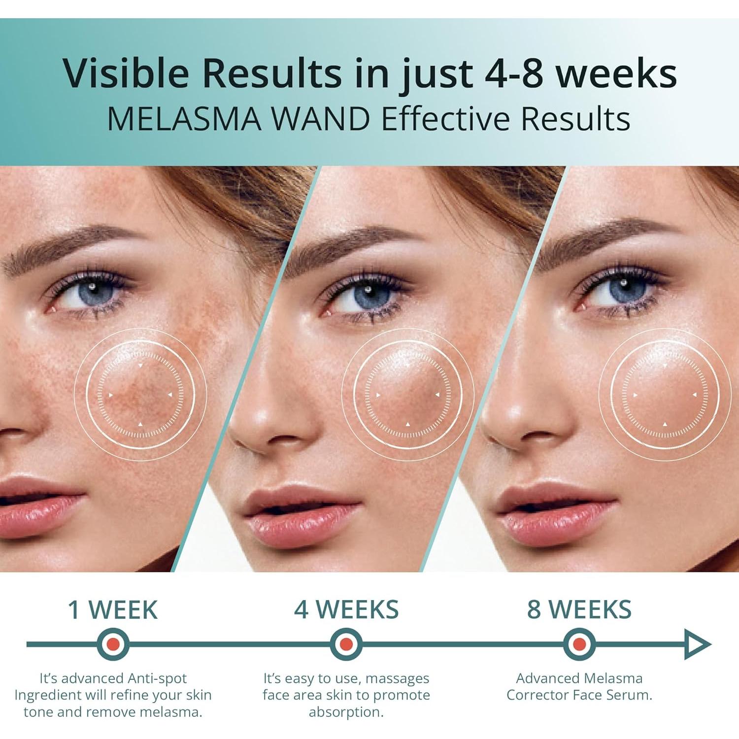 Suero Abera Melasma Plus 29.57 ml - Tratamiento de Manchas Oscuras