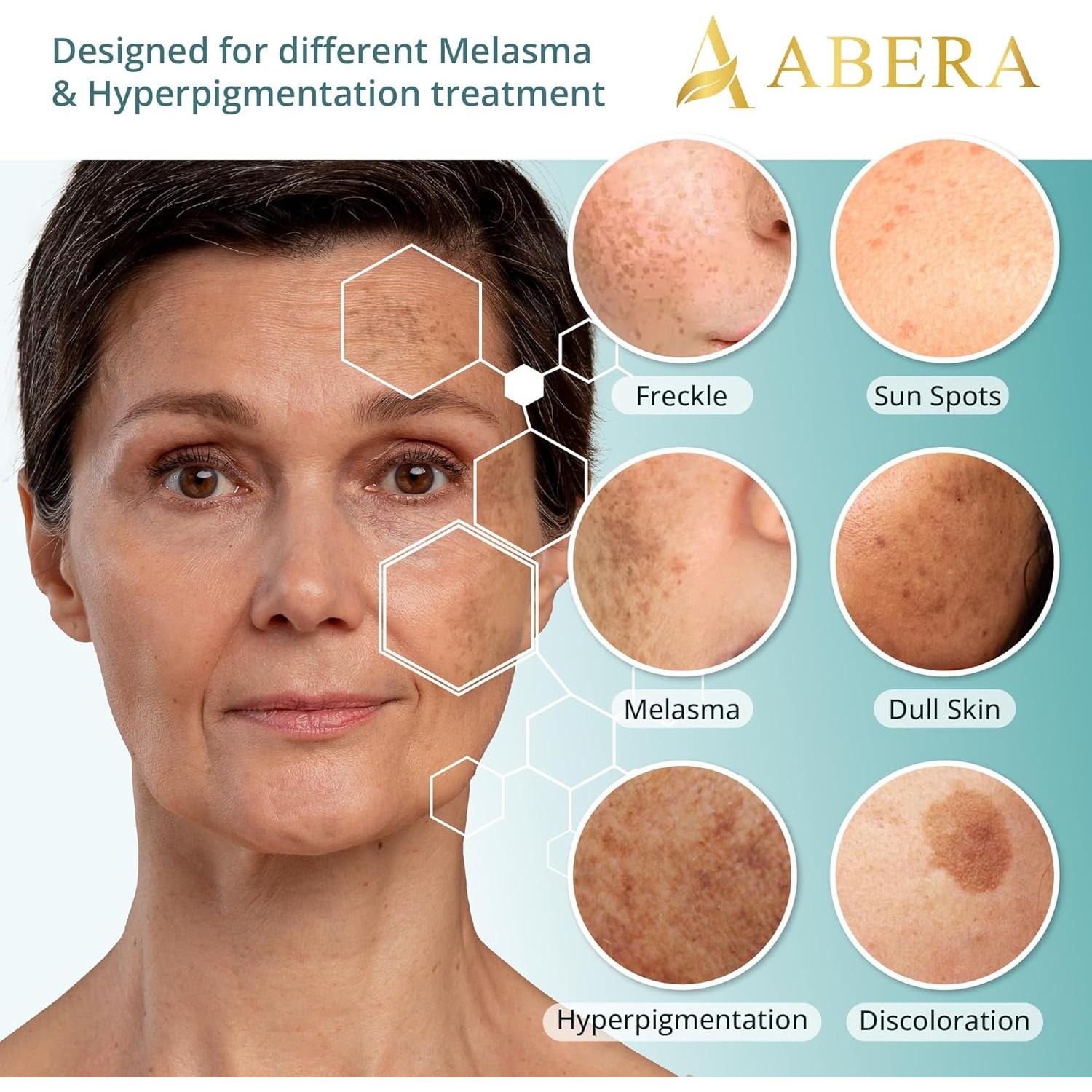 Suero Abera Melasma Plus 29.57 ml - Tratamiento de Manchas Oscuras