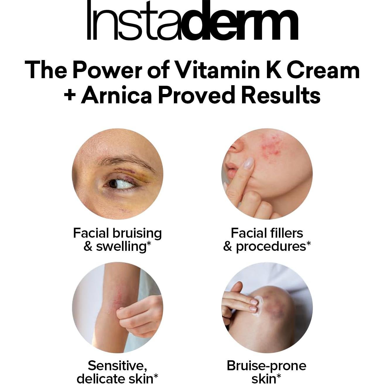 Crema de Vitamina K Instaderm 149g - Hidratante para Moretones