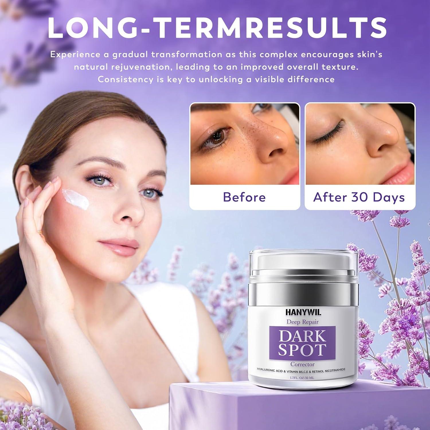 HANYWIL Removedor de Manchas Oscuras 50 ml - Suero y Crema