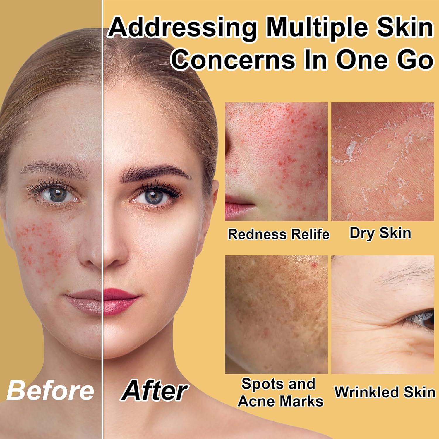 Set de Cuidado de la Piel GOWLAVER para Adolescentes Hidratante