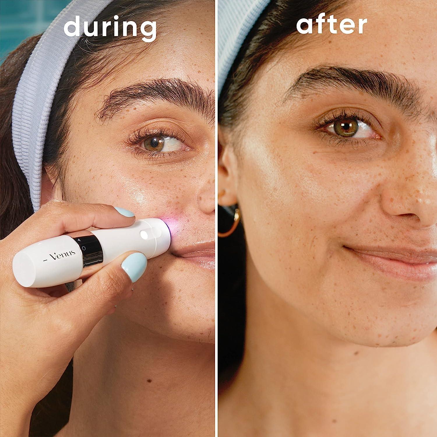 Gillette Venus Mini Afeitadora Facial Eléctrica Portátil