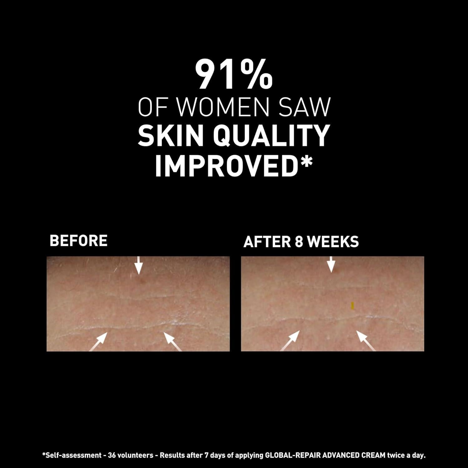 Filorga Global-Repair Advanced Anti Aging Daily Face Cream Bundle