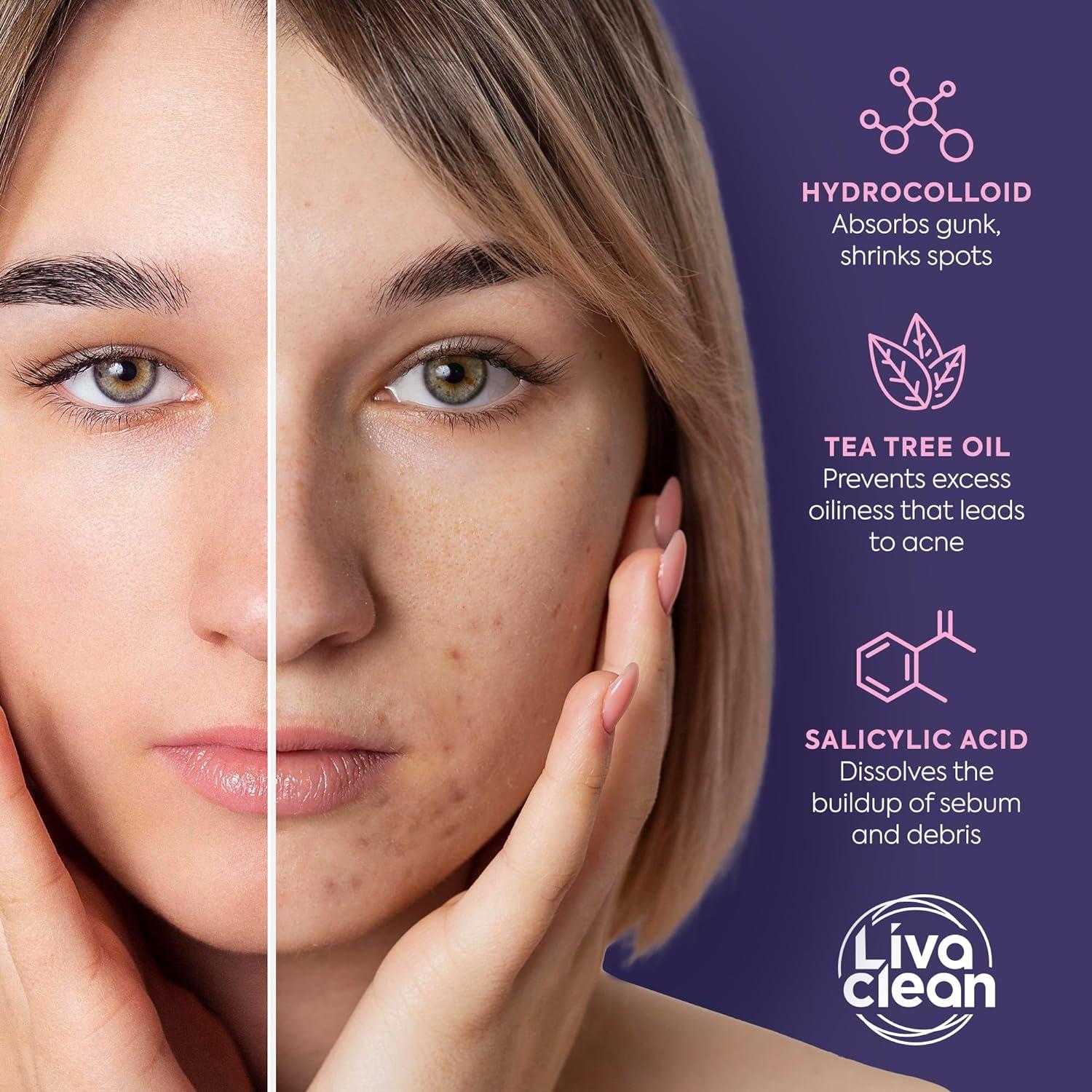 Parche Estelar LivaClean para Acné 240 Parches Hidrocoloide