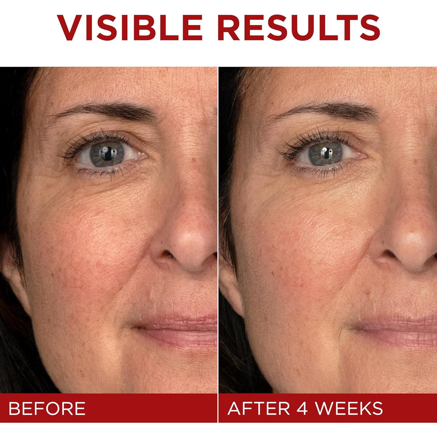 Crema Hidratante Facial L'Oreal Revitalift 72g Anti-Envejecimiento