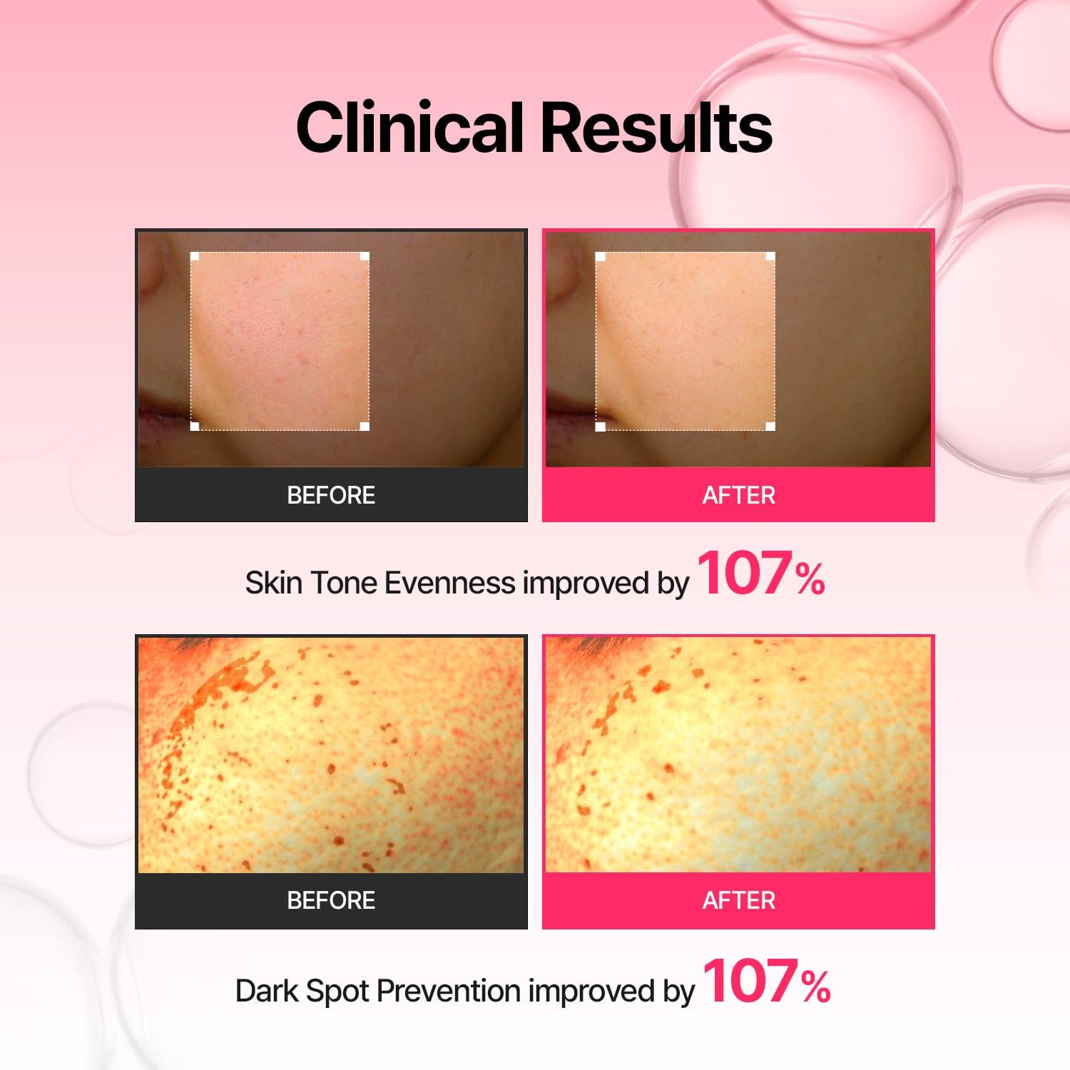 Suero Potenciador de Piel Meditherapy 150 ml - 10% Niacina y 2% Arbutina