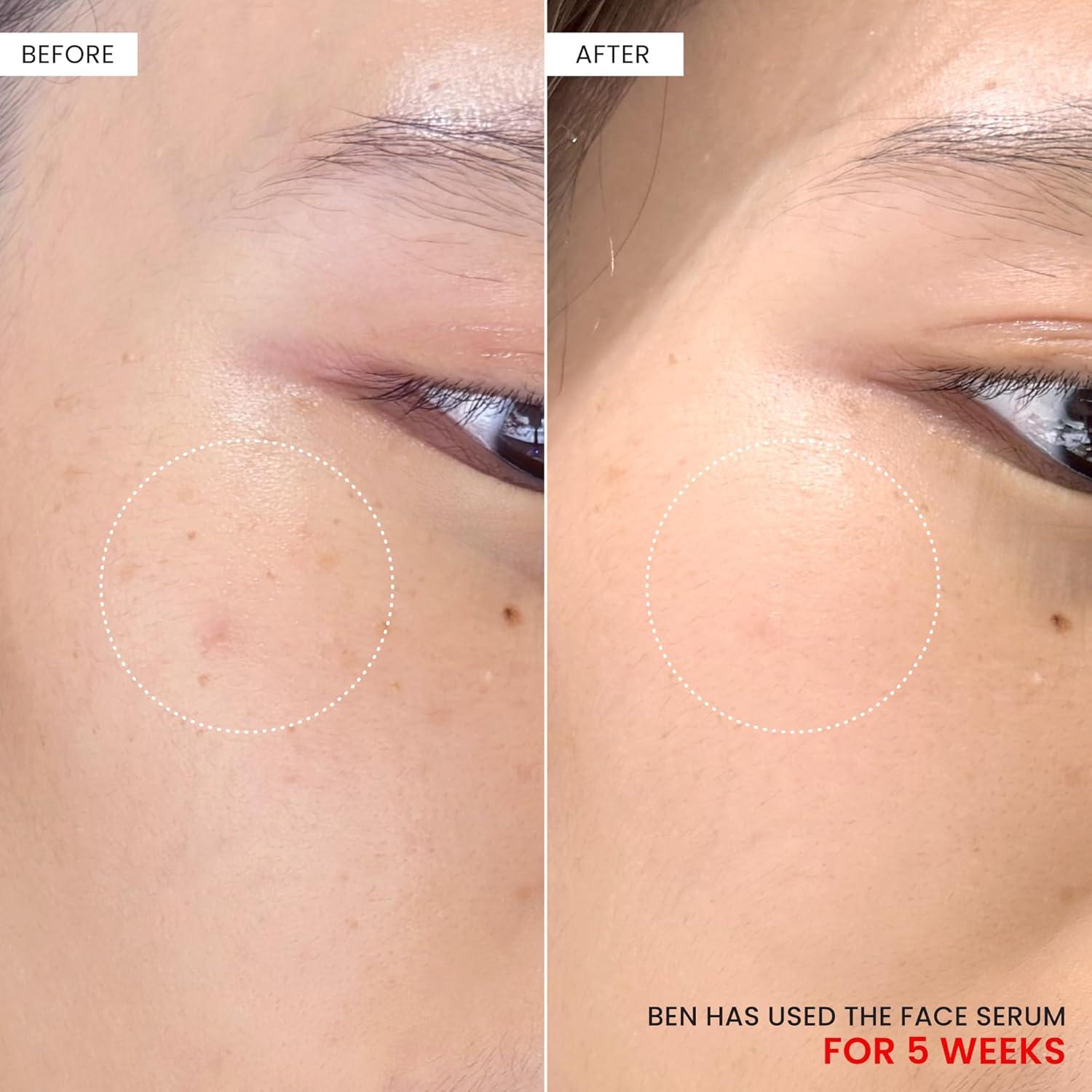 Suero Facial Koji White 30 ml - Ácido Kójico 2% + Tranexámico 3% + Niacinamida 5%