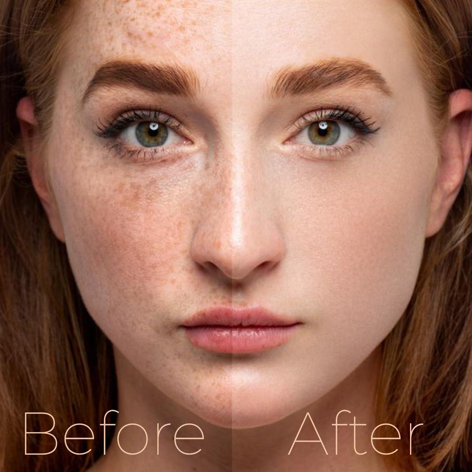 Crema Blanqueadora Indus Valley Gel Despigmentante 50ml