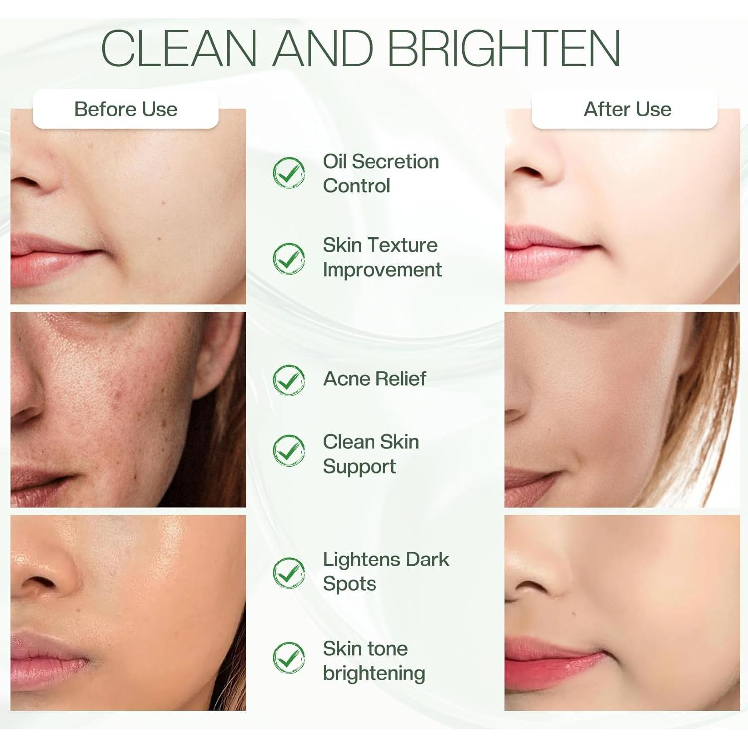 Discos Exfoliantes Faciales Jtopyrt 20% Ácido Glicólico 60 Unidades