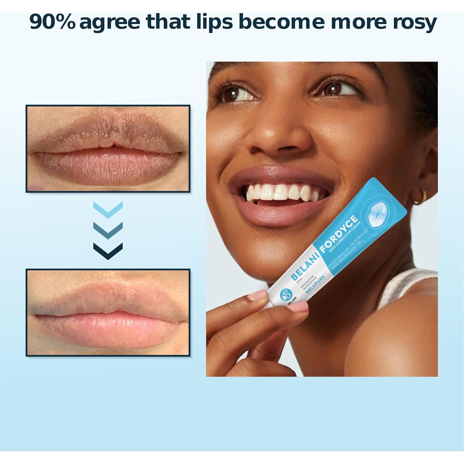 Crema Labial Belani para Acné y Sequedad 19.84 g