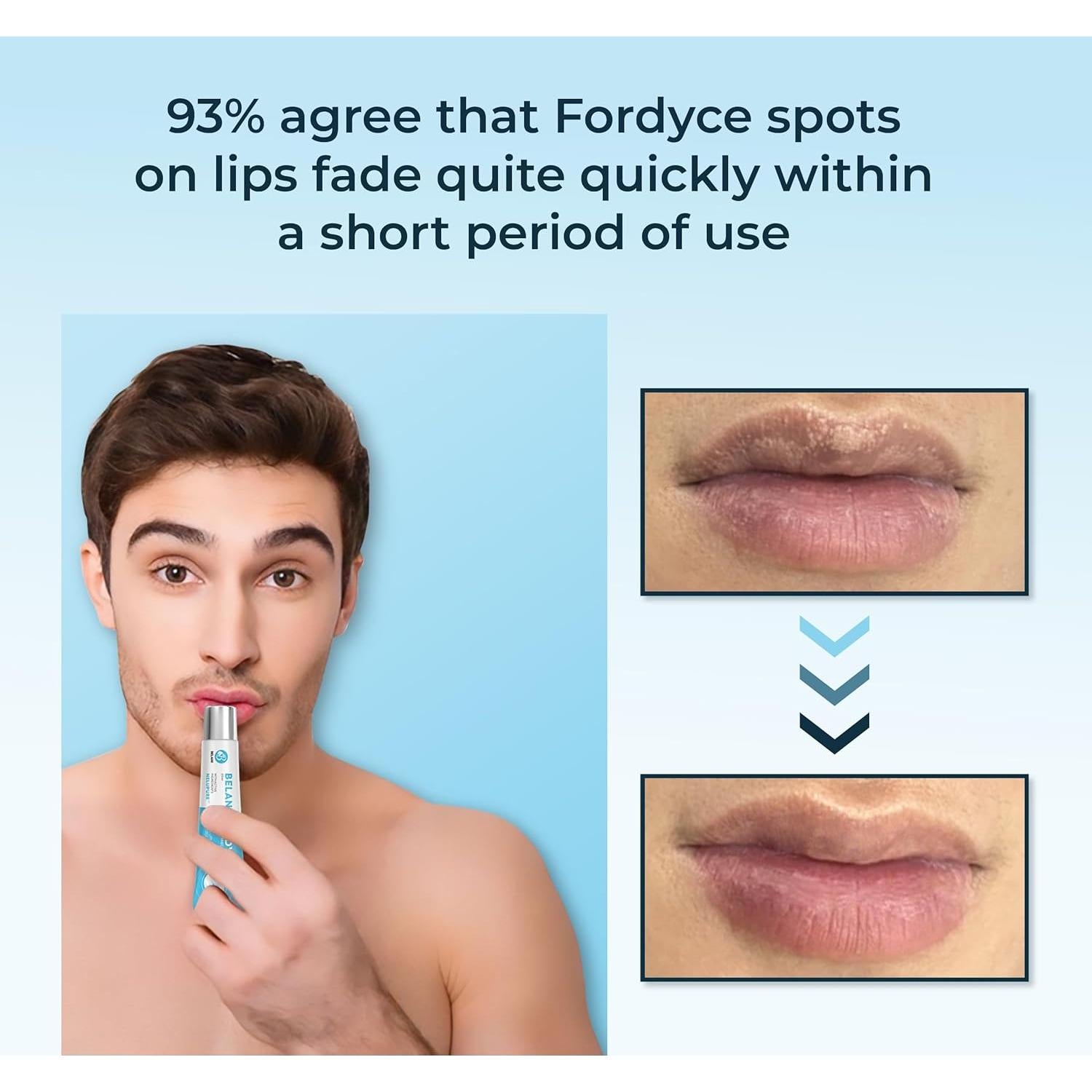 Crema Labial Belani para Acné y Sequedad 19.84 g