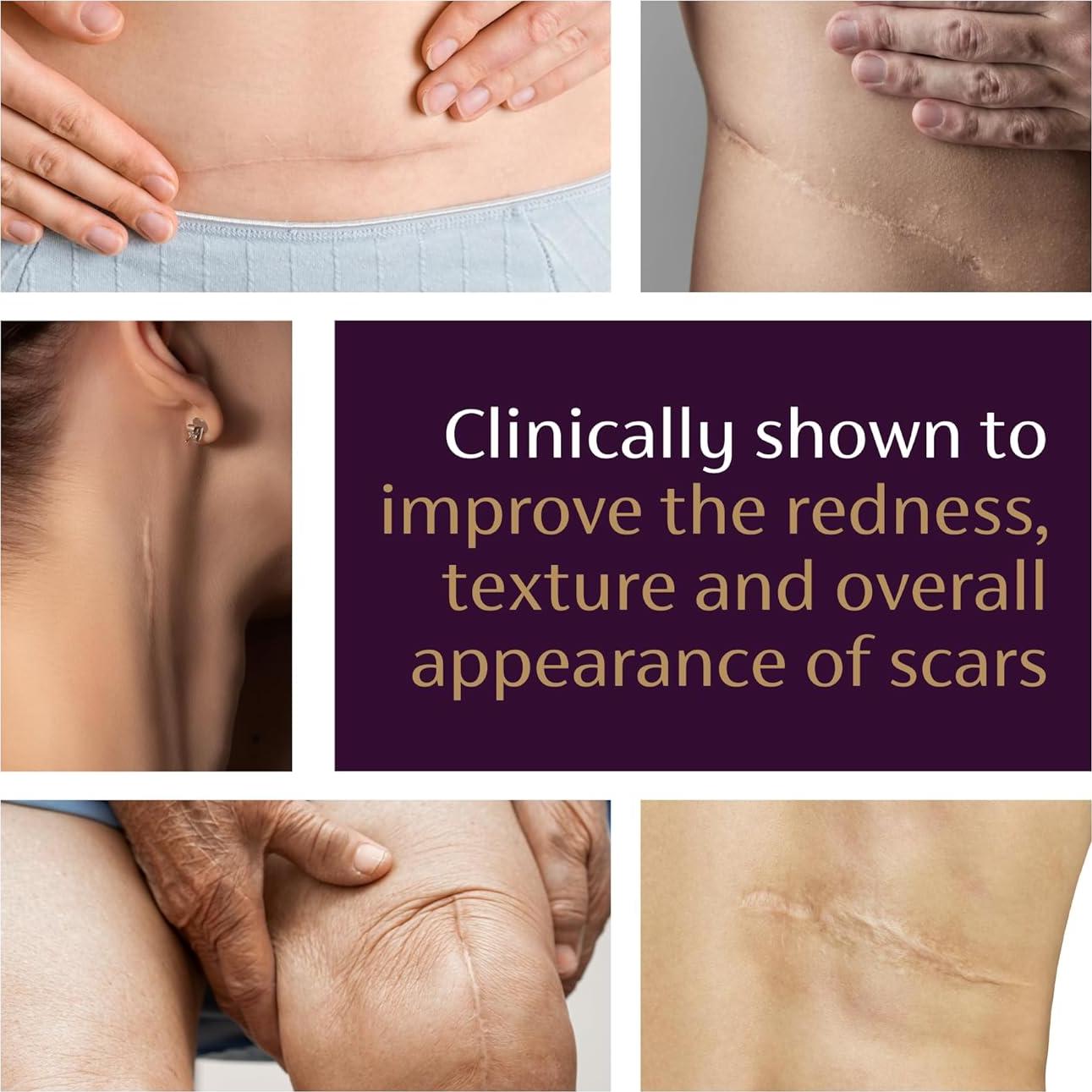 Mederma Gel Avanzado para Cicatrices 50g - Reduce Cicatrices Viejas y Nuevas