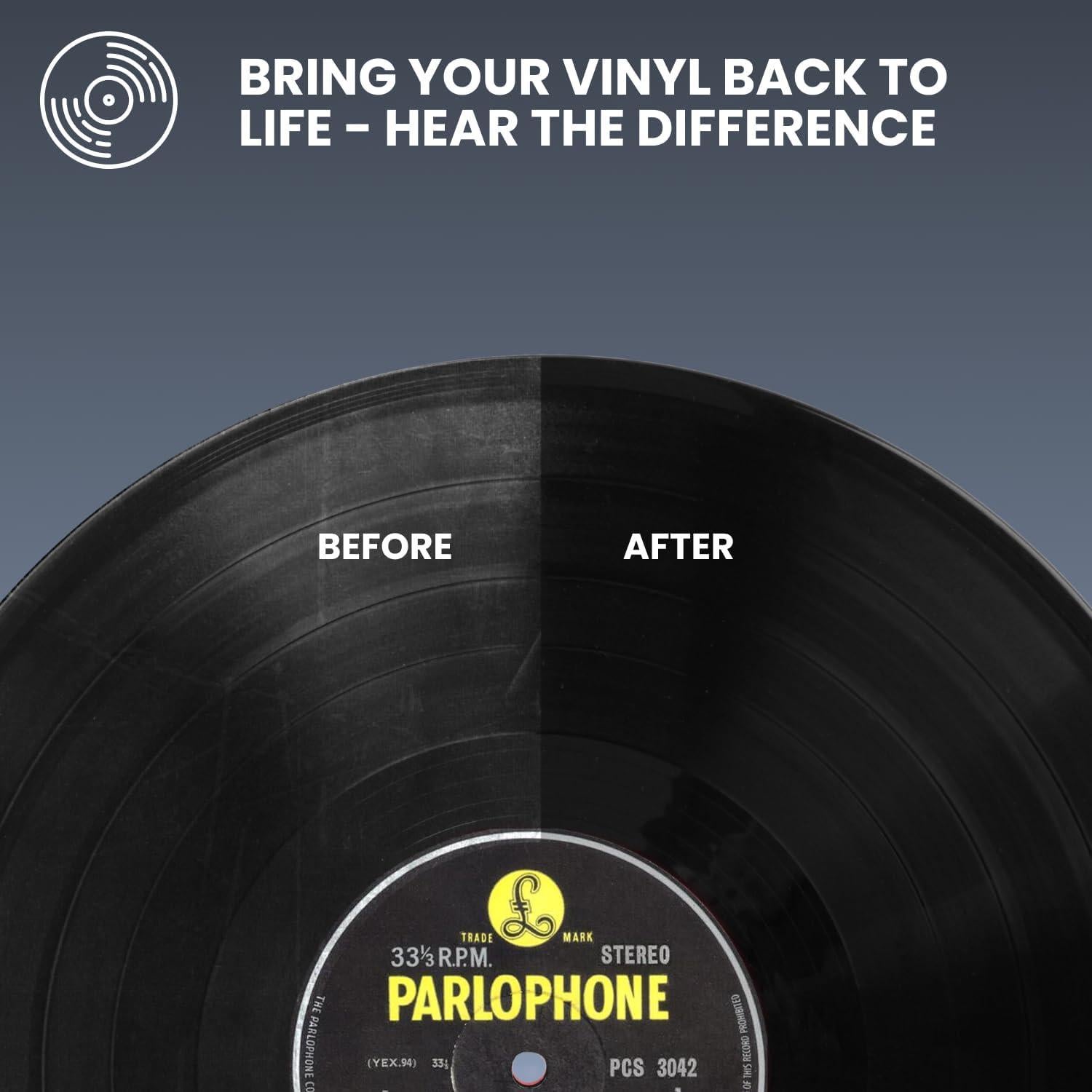 Kit de Limpieza de Discos de Vinilo Big Fudge 4 en 1