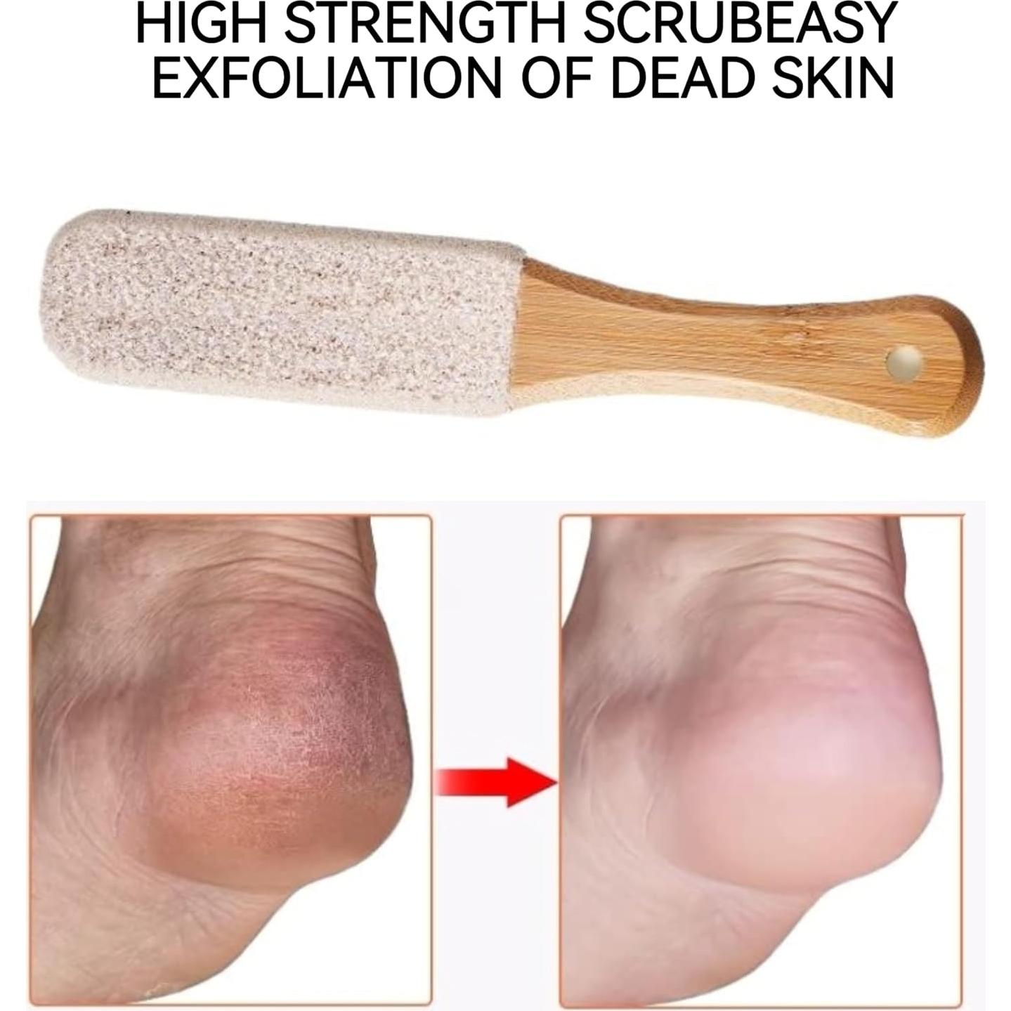 Paquete de 2 Archivos de Pies NZOZKOEX - Exfoliantes de Callos