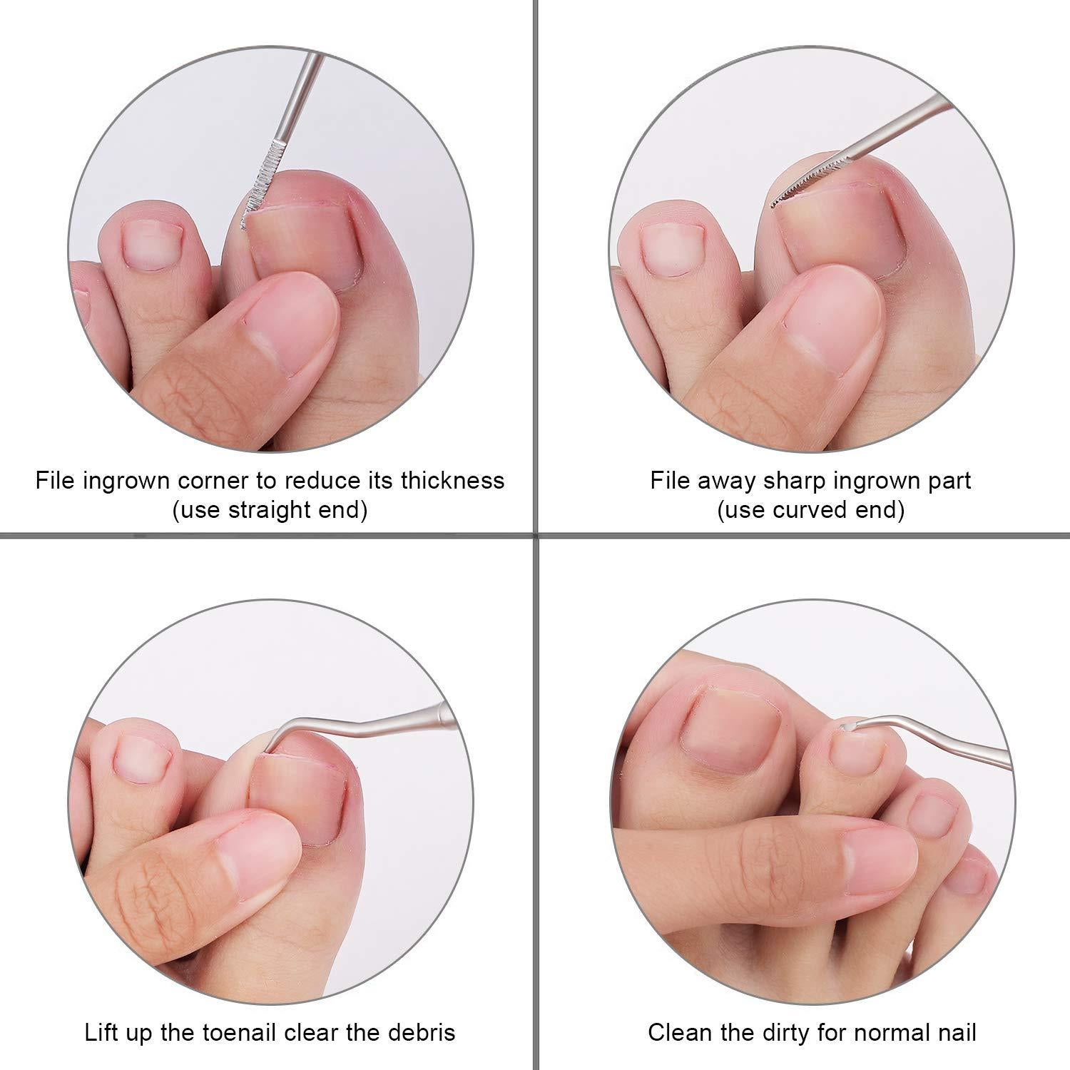 Kit de Herramientas para Uñas Encarnadas YINYIN Acero Inoxidable