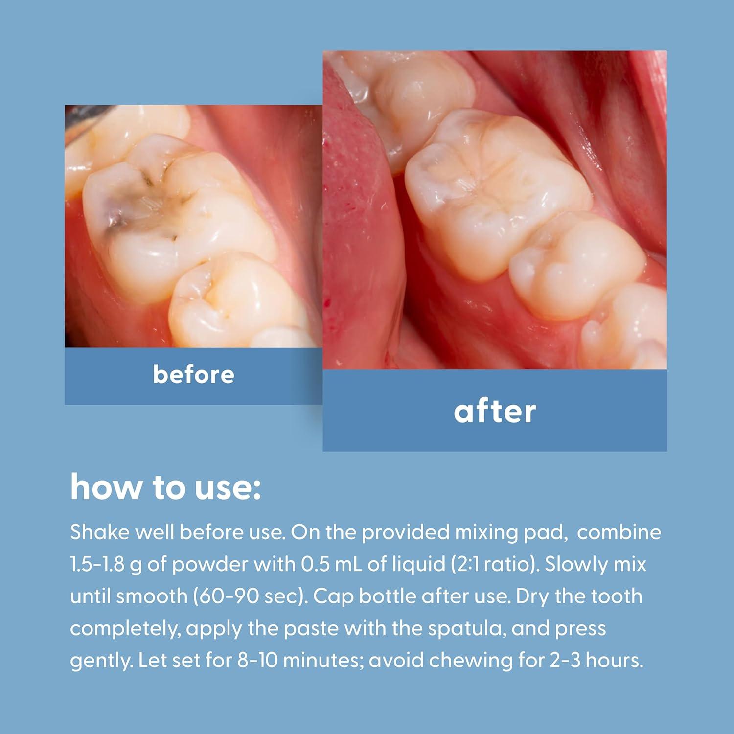 Kit de Reparación Dental M3 Naturals - Relleno Temporal para Dientes