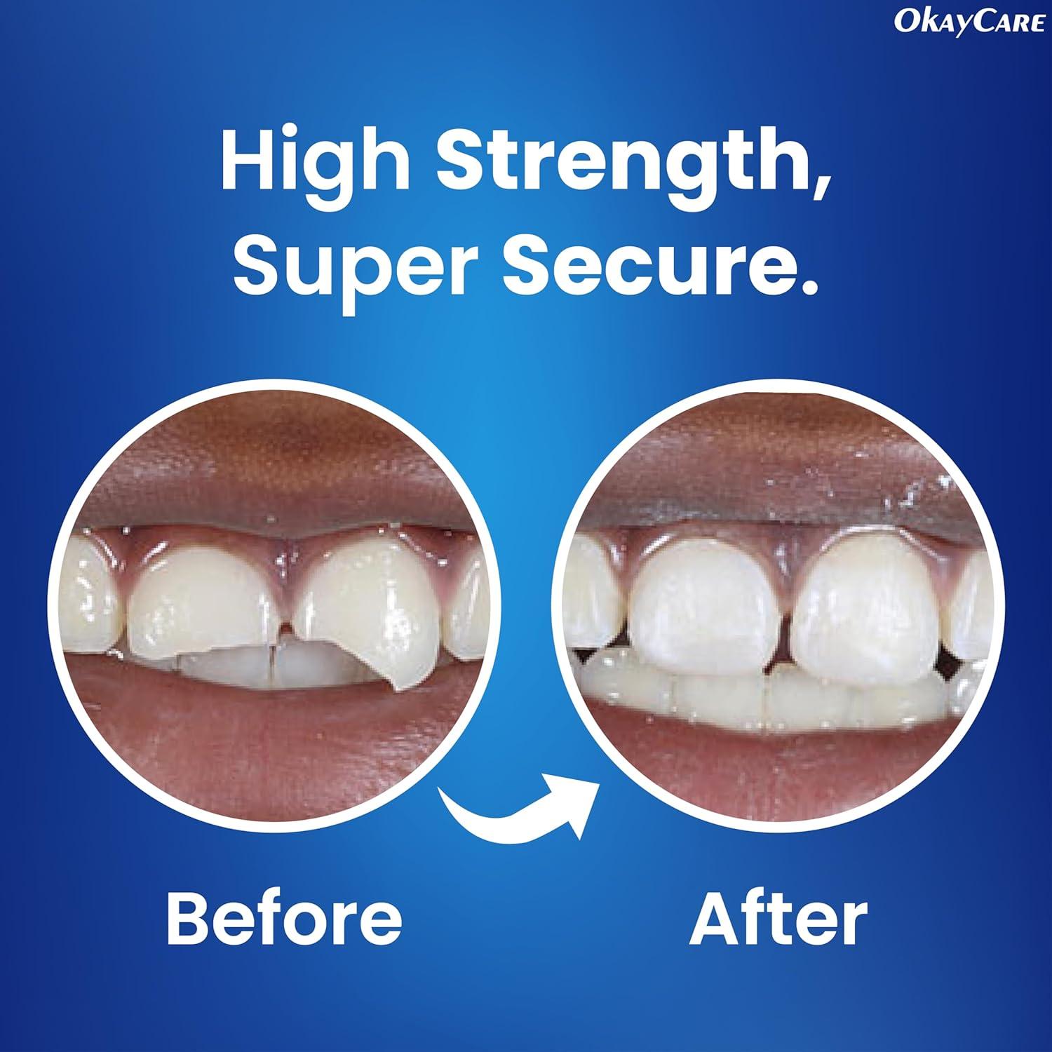 Cemento Dental de Óxido de Zinc Eugenol - Kit Reparación 15ml