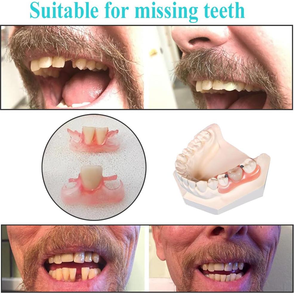 Kit de Dientes Falsos DIY Longkason - Dentadura Completa y Parcial