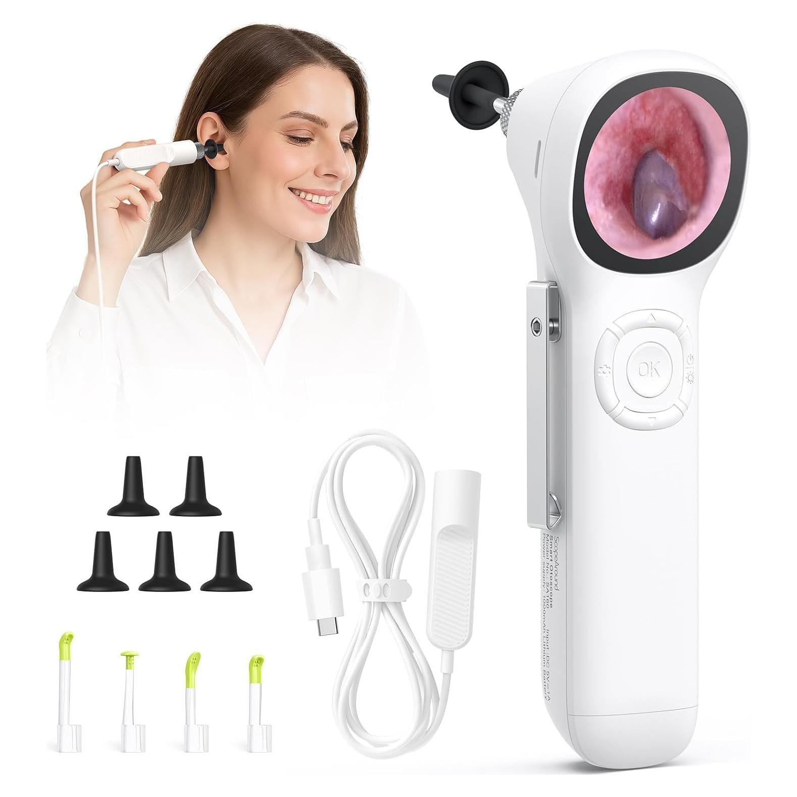 Otoscopio Digital ScopeAround SA160 con Pantalla IPS 3.68 cm