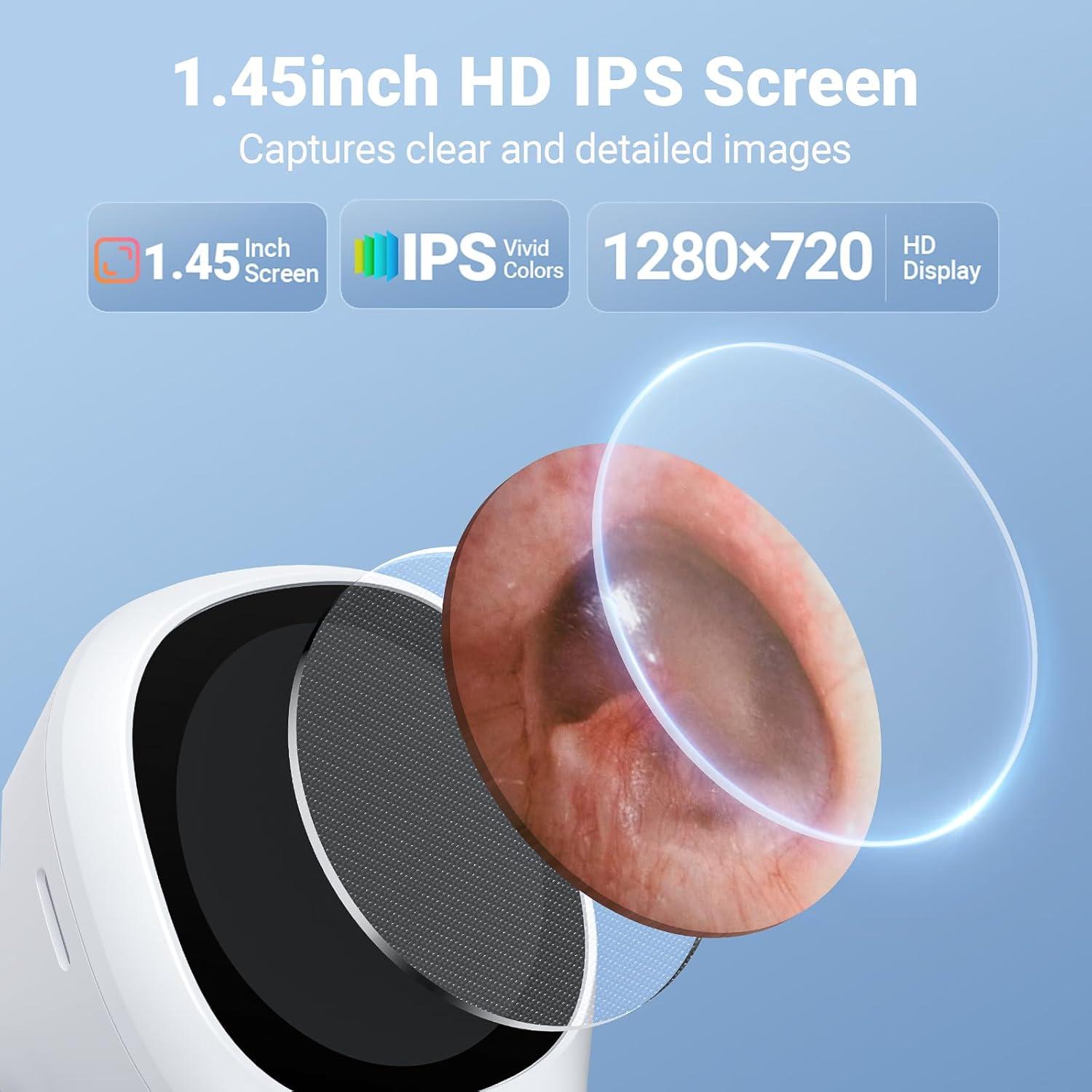 Otoscopio Digital ScopeAround SA160 con Pantalla IPS 3.68 cm