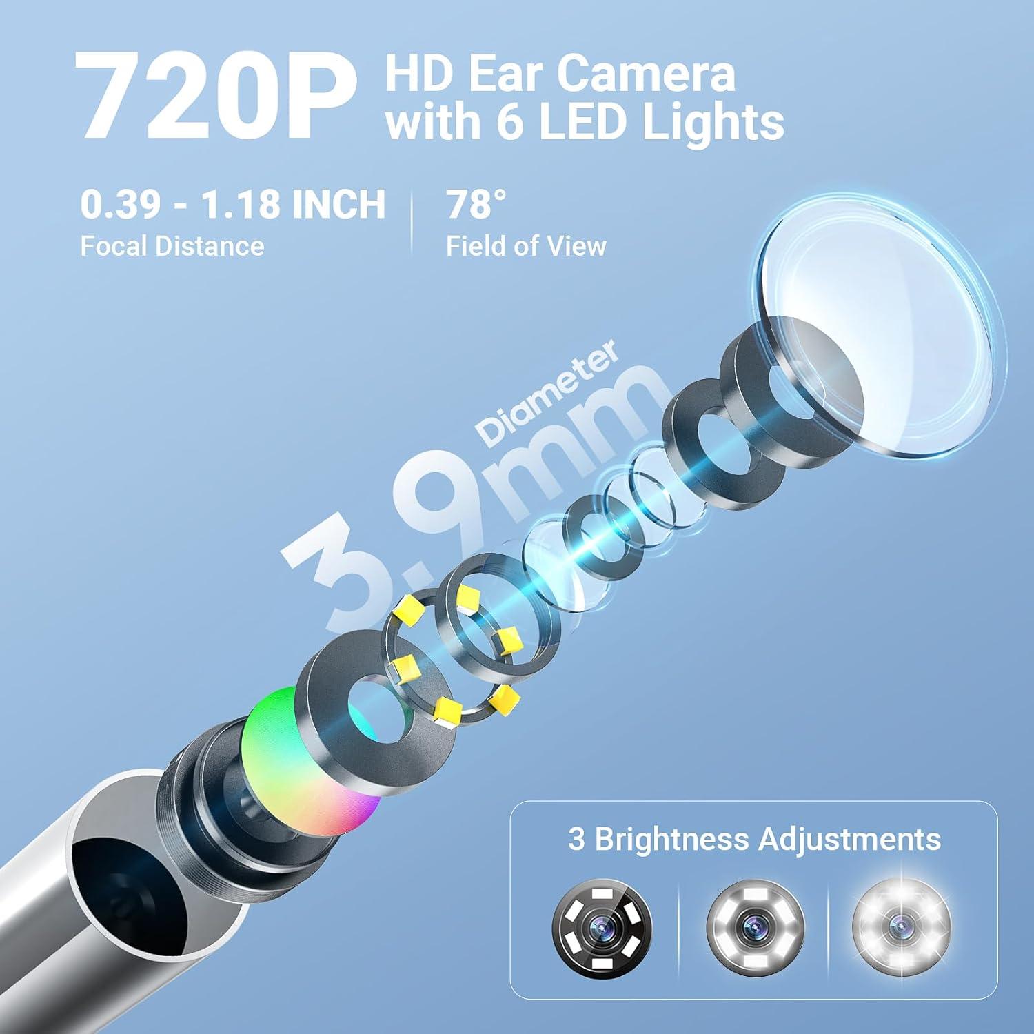 Otoscopio Digital ScopeAround SA160 con Pantalla IPS 3.68 cm