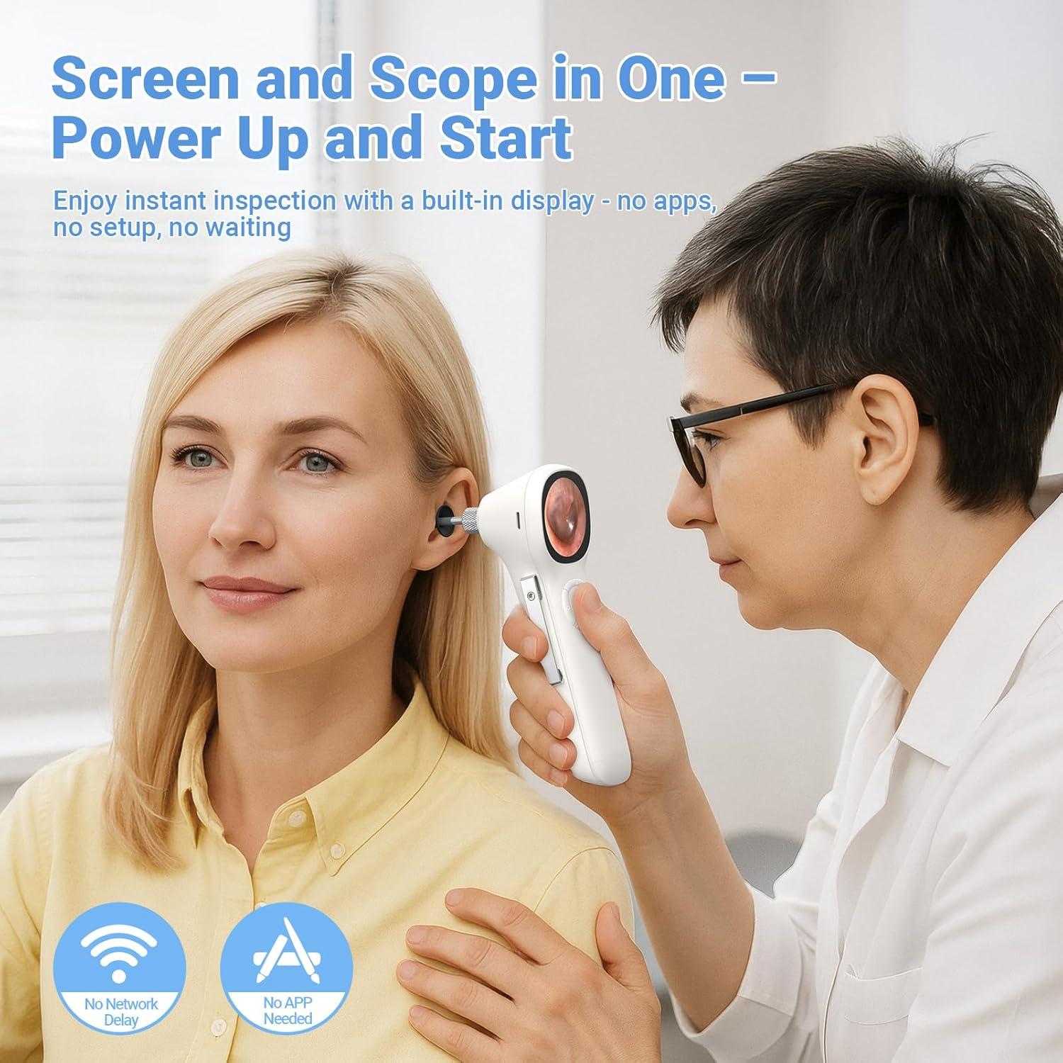 Otoscopio Digital ScopeAround SA160 con Pantalla IPS 3.68 cm