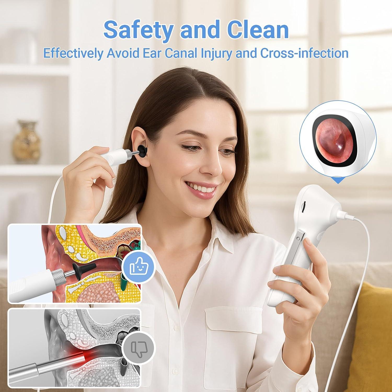 Otoscopio Digital ScopeAround SA160 con Pantalla IPS 3.68 cm