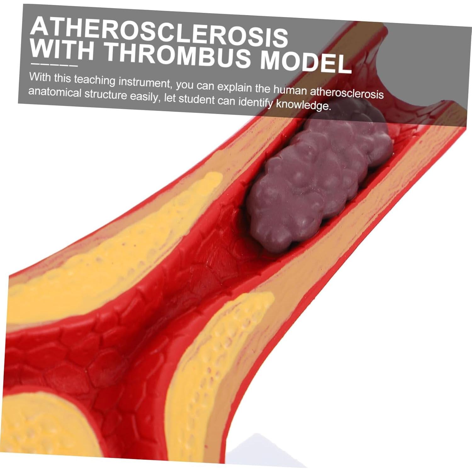 Modelo Anatómico Cardiovascular FELTECHELECTR 17.97x15.98 cm