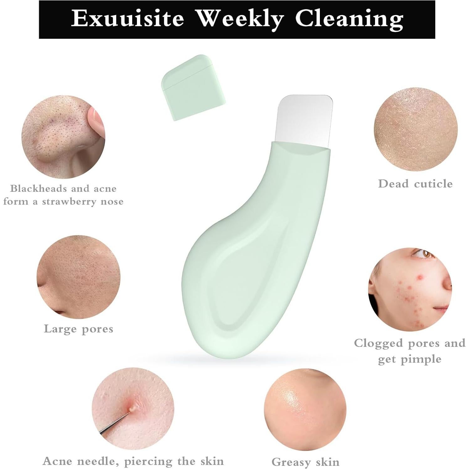 Raspador de Puntos Negros Sookga Silicona Verde 12cm