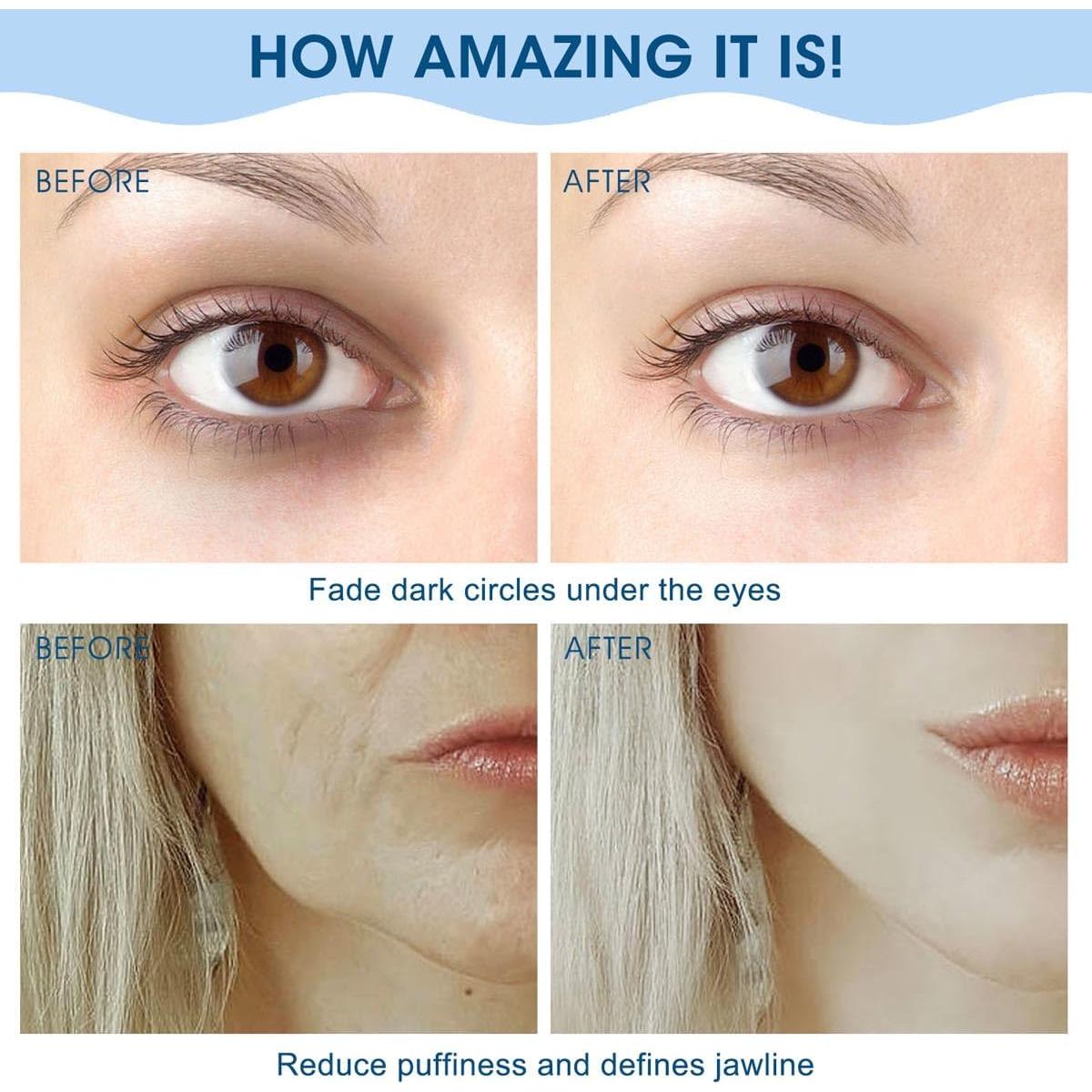 Rodillo Facial Bealihelp Acero Inoxidable Masajeador