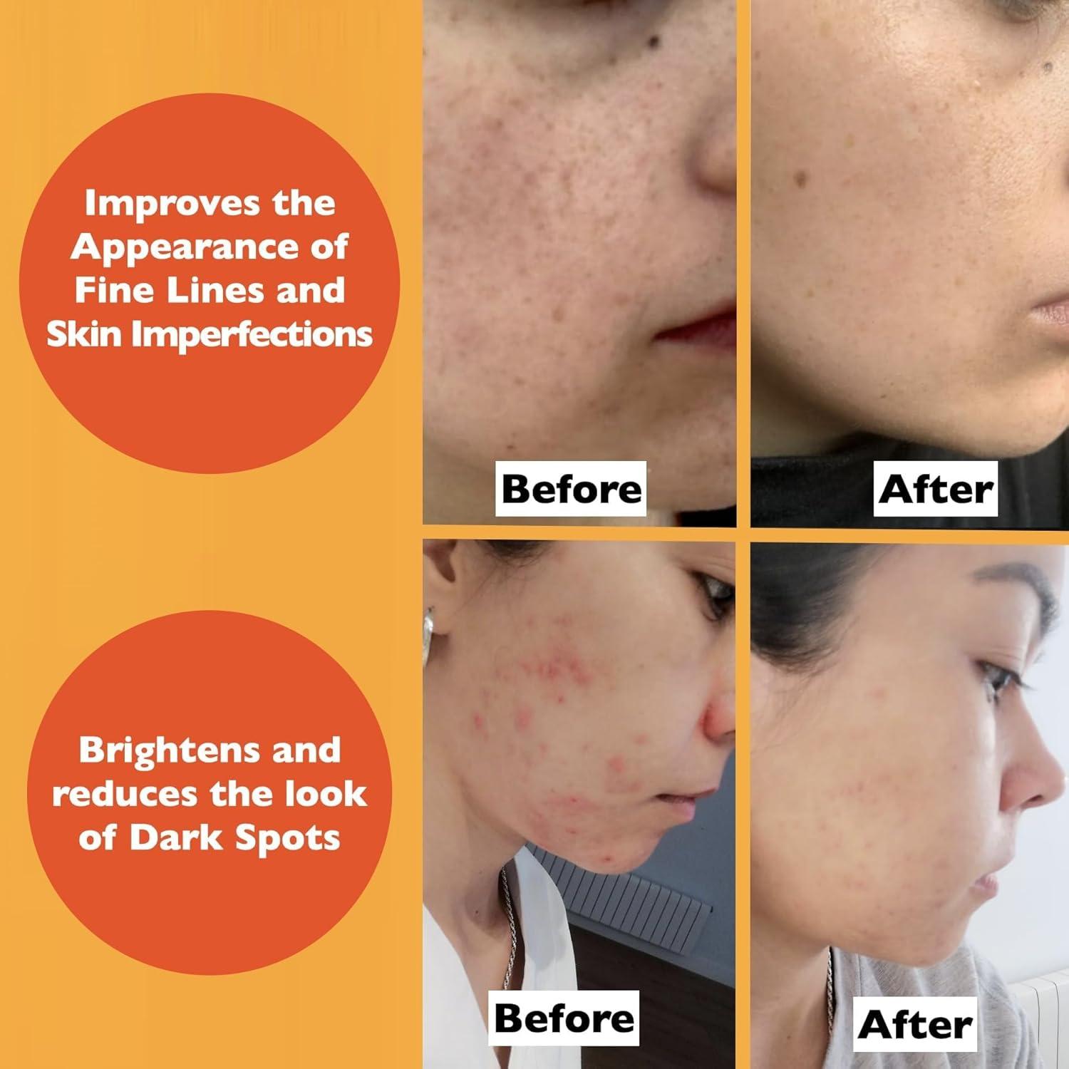 Suero Facial Antienvejecimiento Vitamina C Florence 60 ml