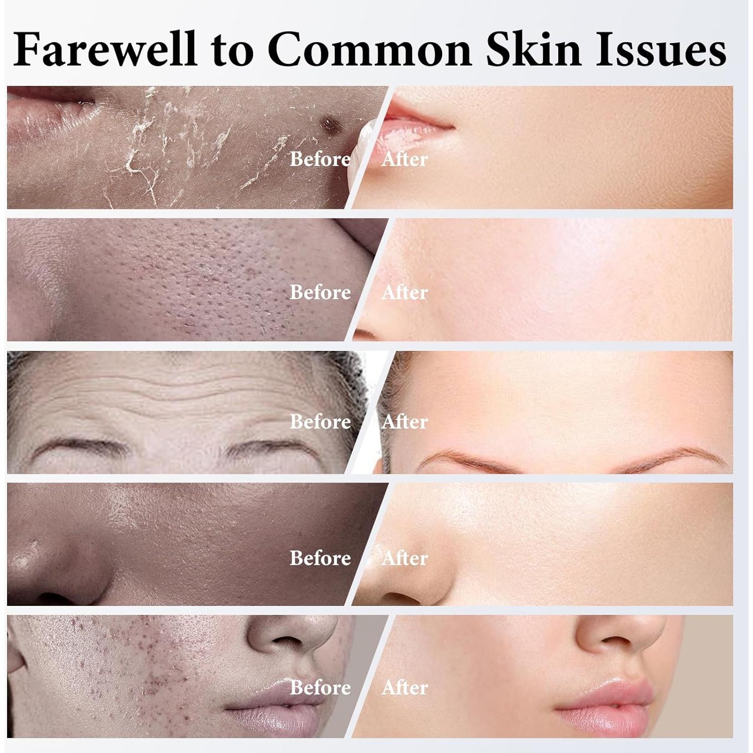 Mascarilla Facial de Colágeno ISTON 4 Paquetes Hidratantes