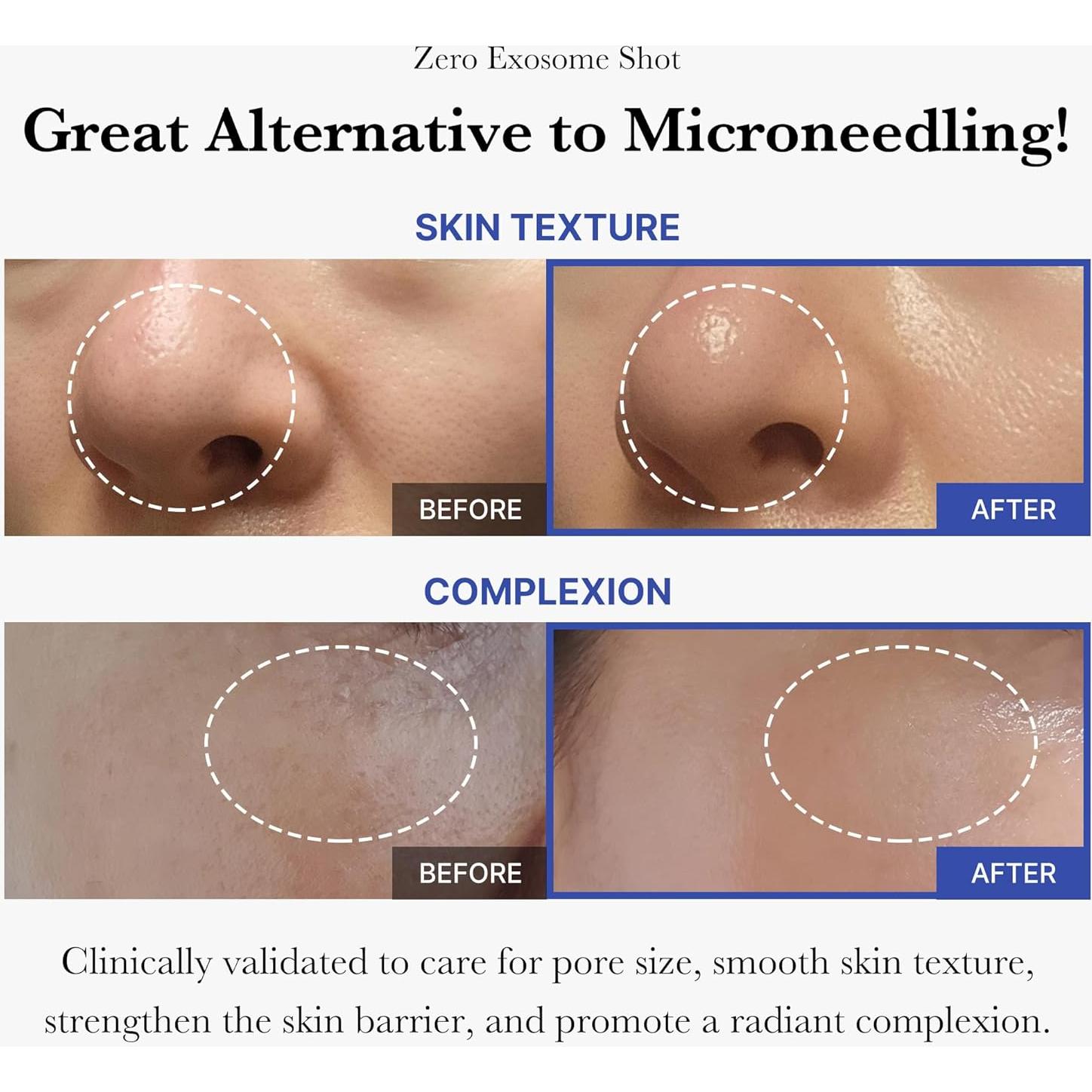 Suero Facial Medicube Zero Exosome 7,500 PPM 80g