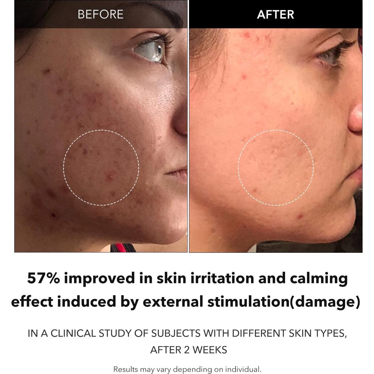 Suero Facial Aclarador APRILSKIN Carrotene 37ml Vegano