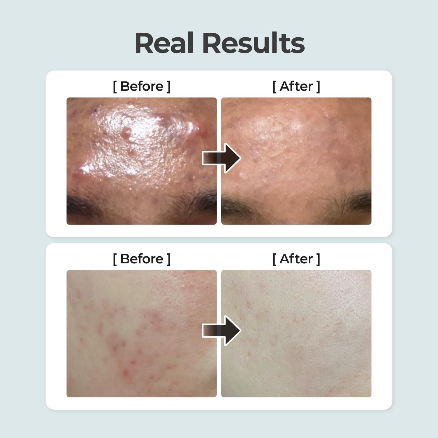 Tónico Herbáceo Calmante Numbuzin 300 ml Piel Sensible