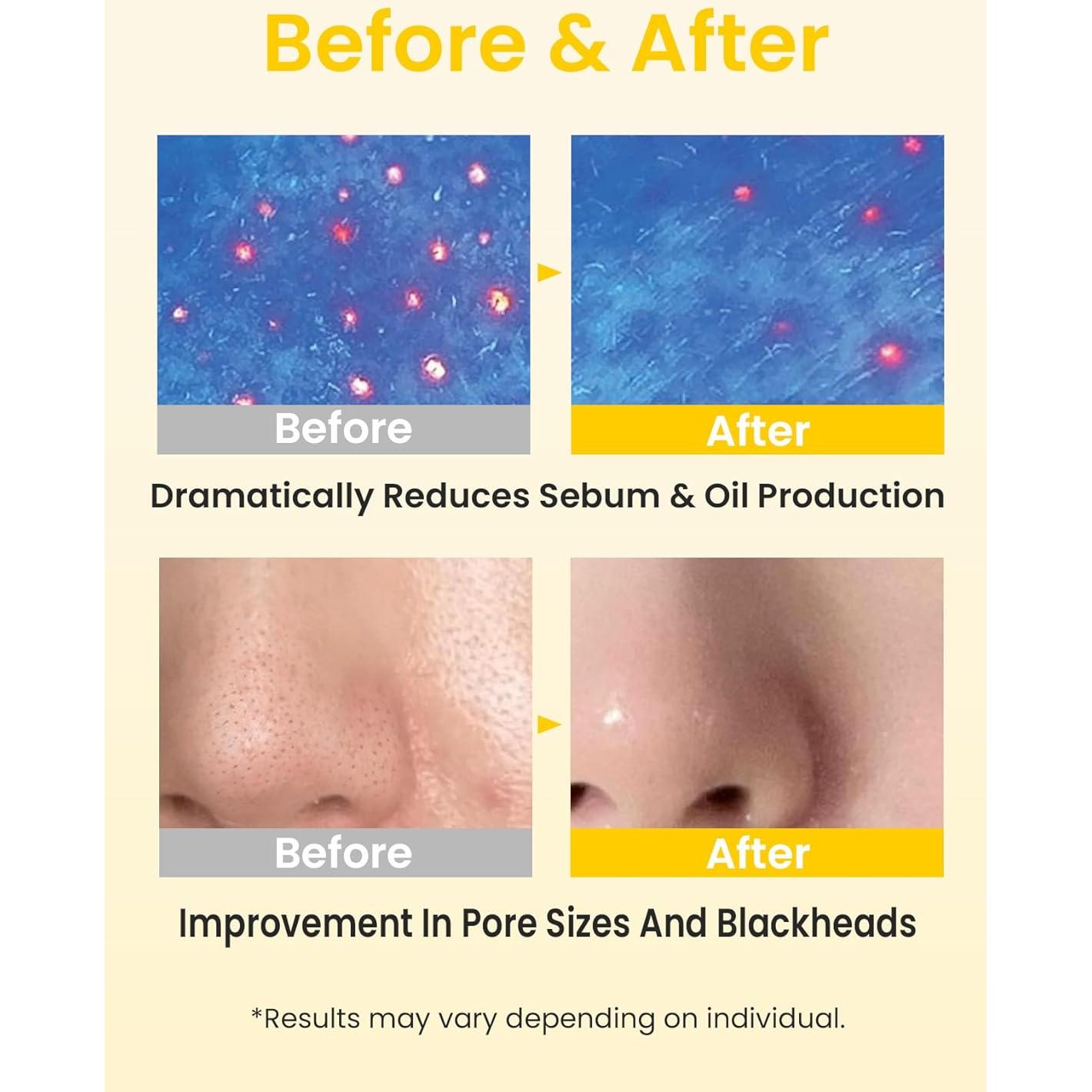 Limpiador de Aceite Elvira para Piel Sensible 180ml