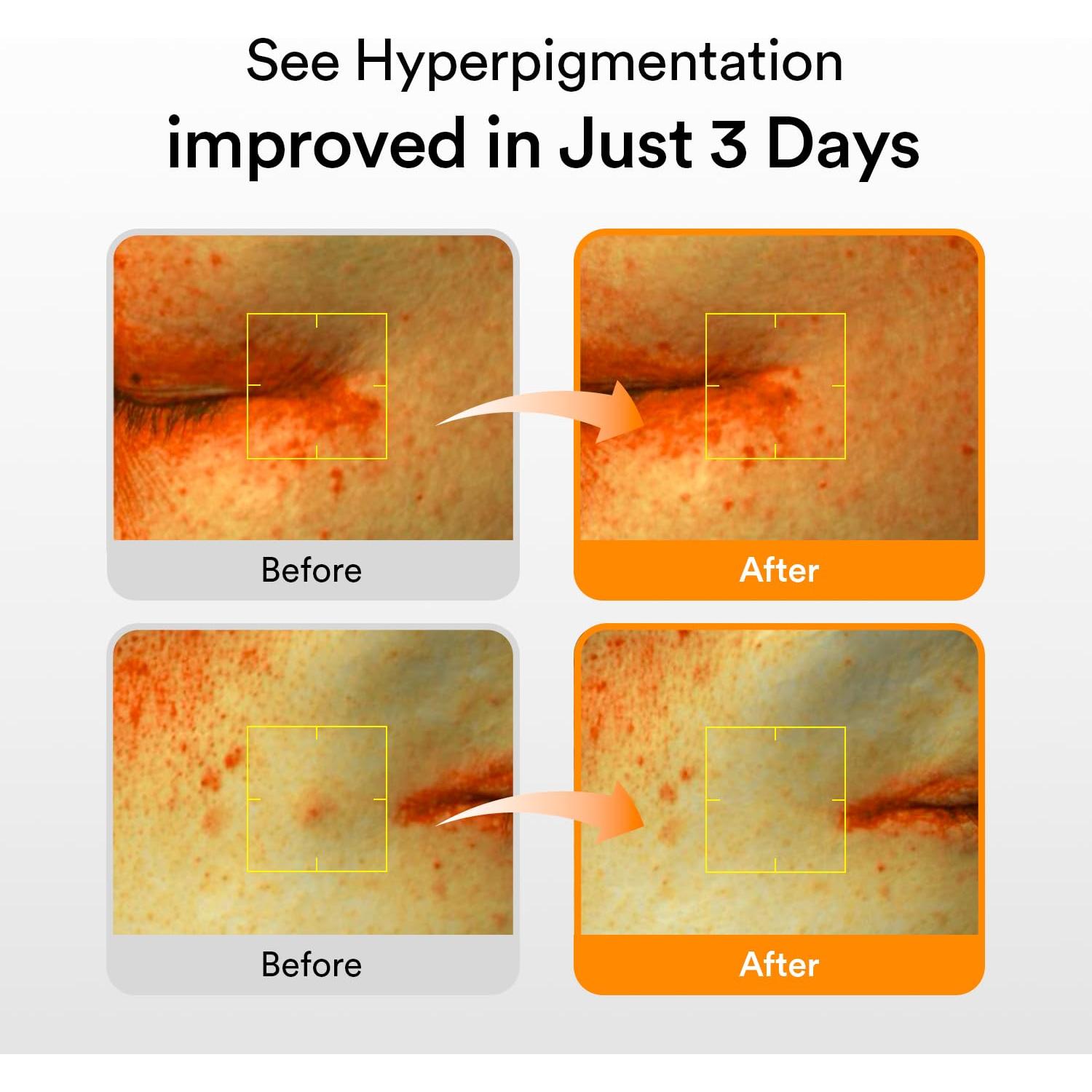 Suero Abib Glutathiosome 50ml - Iluminador para Manchas Oscuras