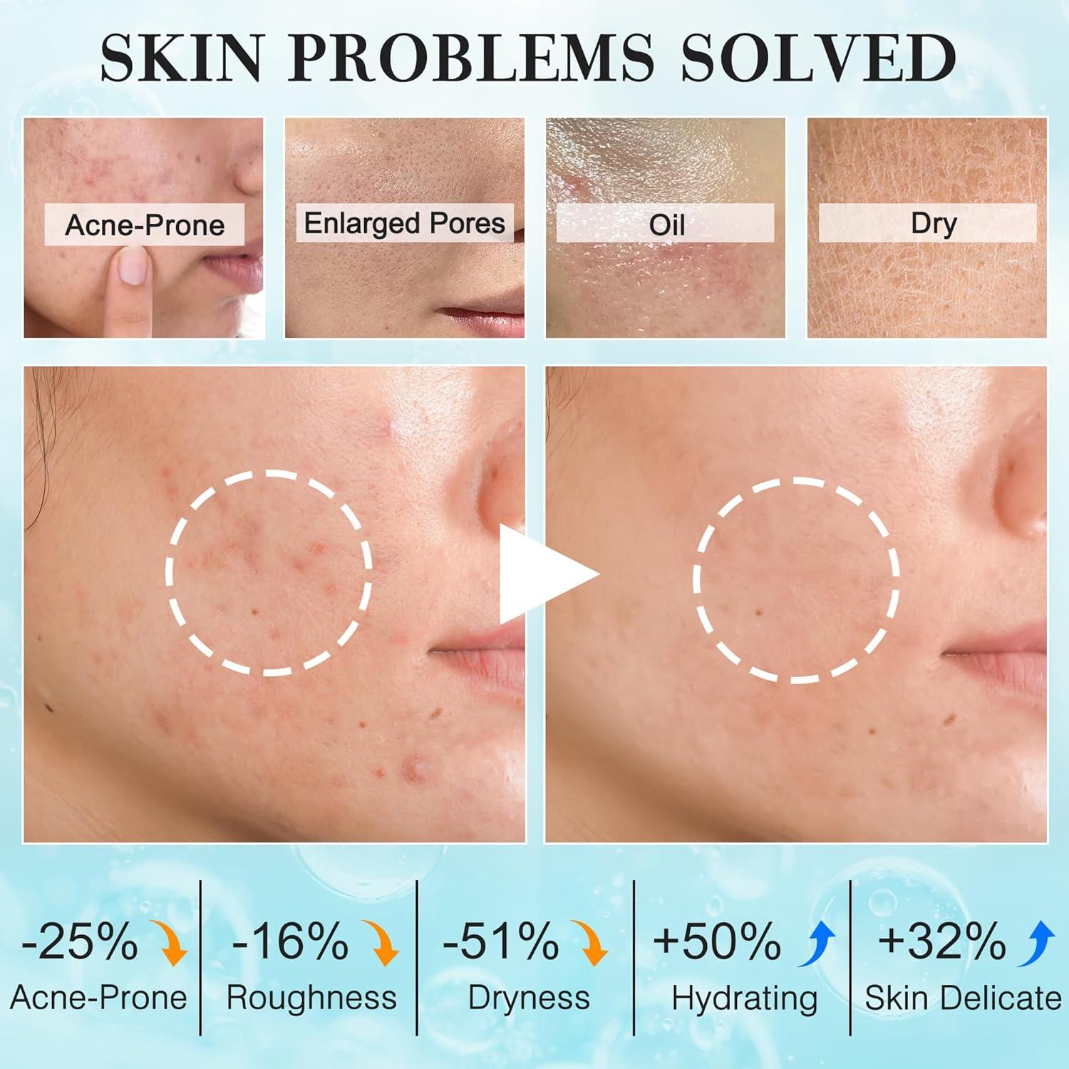 Set Cuidado Facial FITOEG para Mujeres y Adolescentes