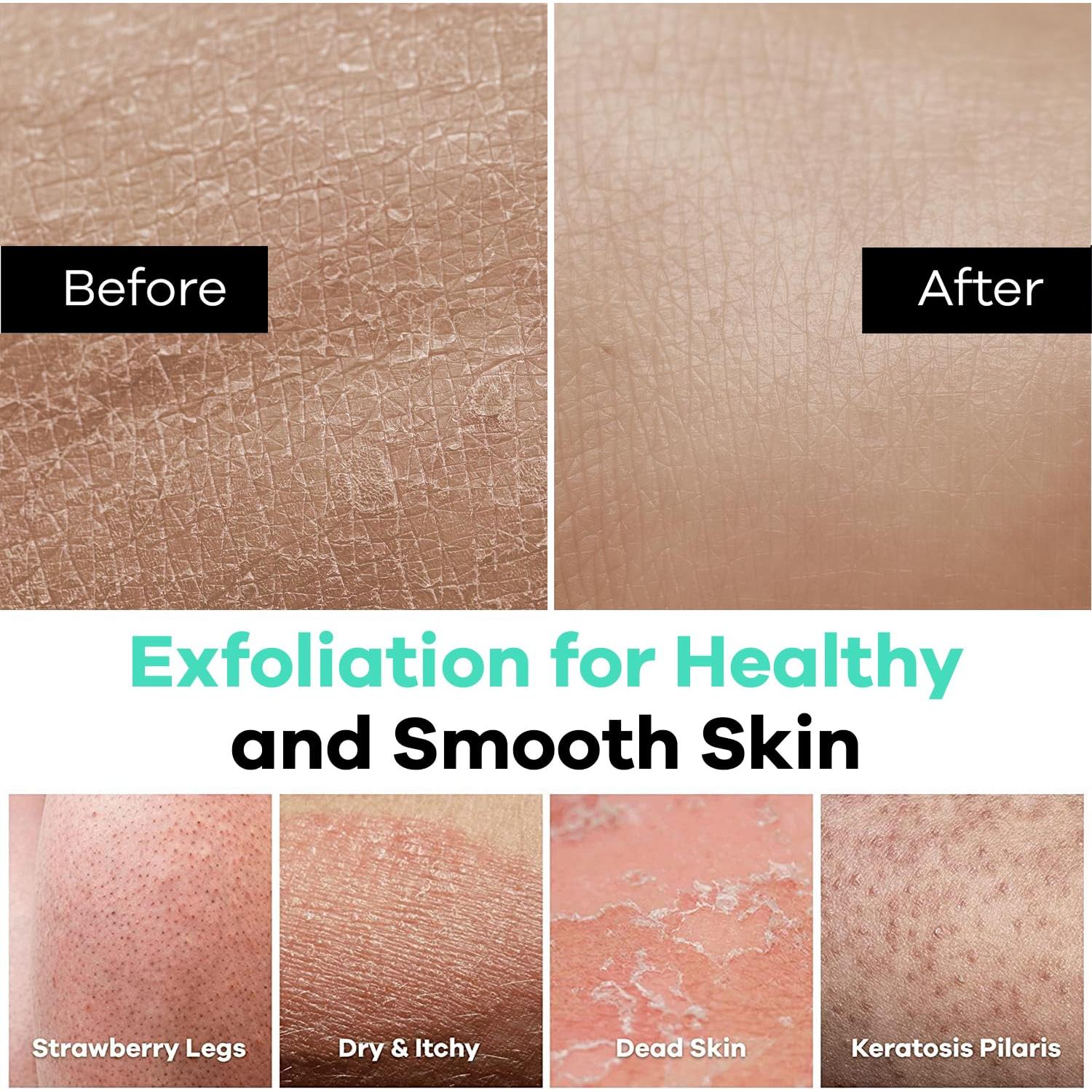 Guante Exfoliante Dermasuri - Mitón para Cuerpo 1 Paquete