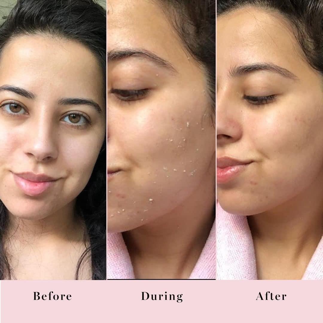 Gel Exfoliante Facial Saturday Skin 90 ml Suave y Efectivo