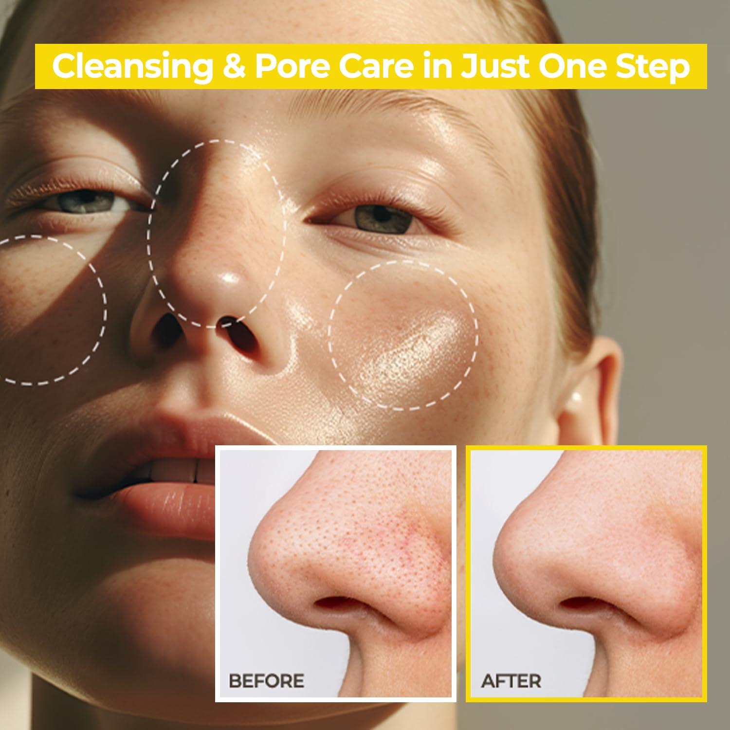 Removedor de Puntos Negros Aceite Limpiador Coreano 300ml