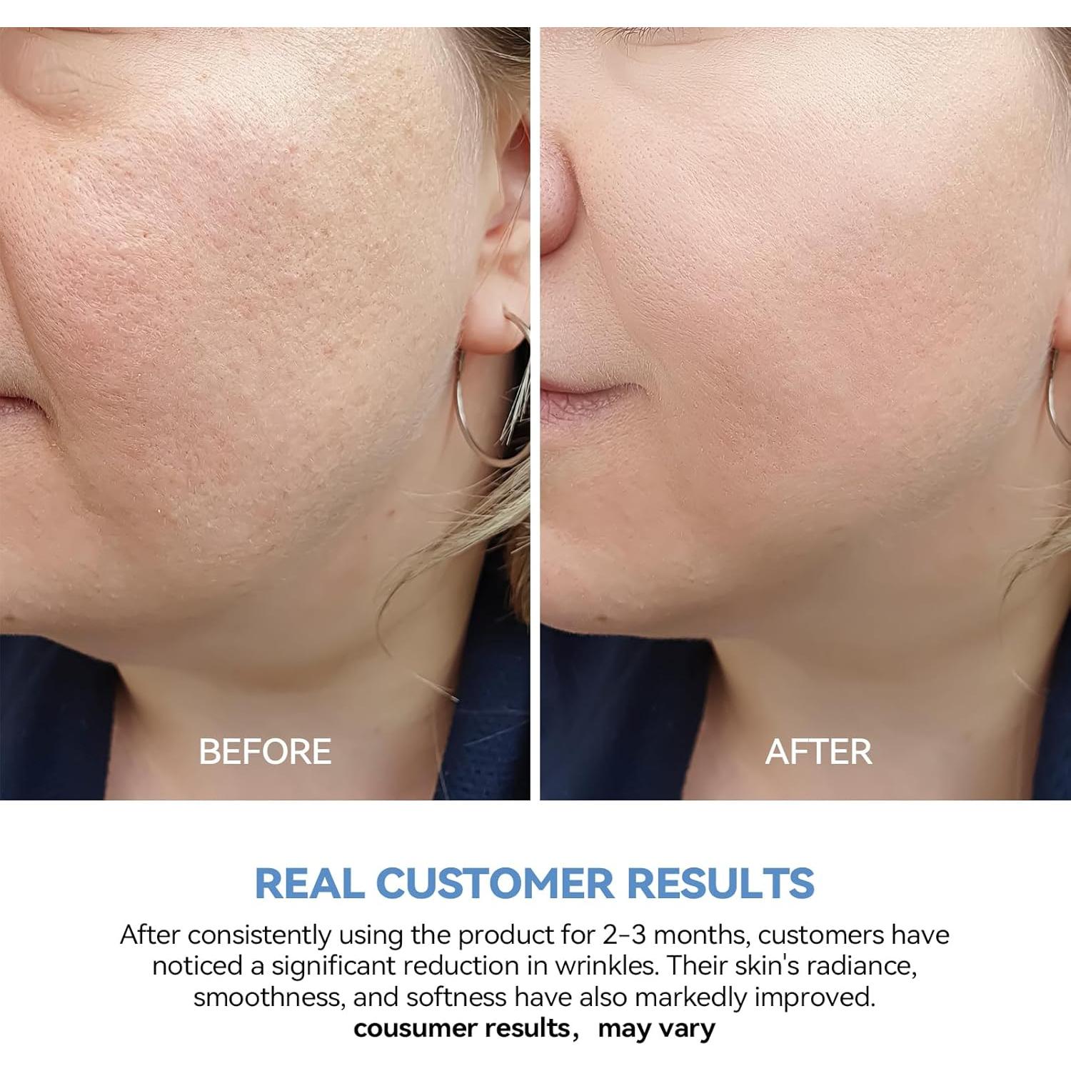 Suero Hidratante WNP 3% Ácido Hialurónico 30 Viales 1.2ml