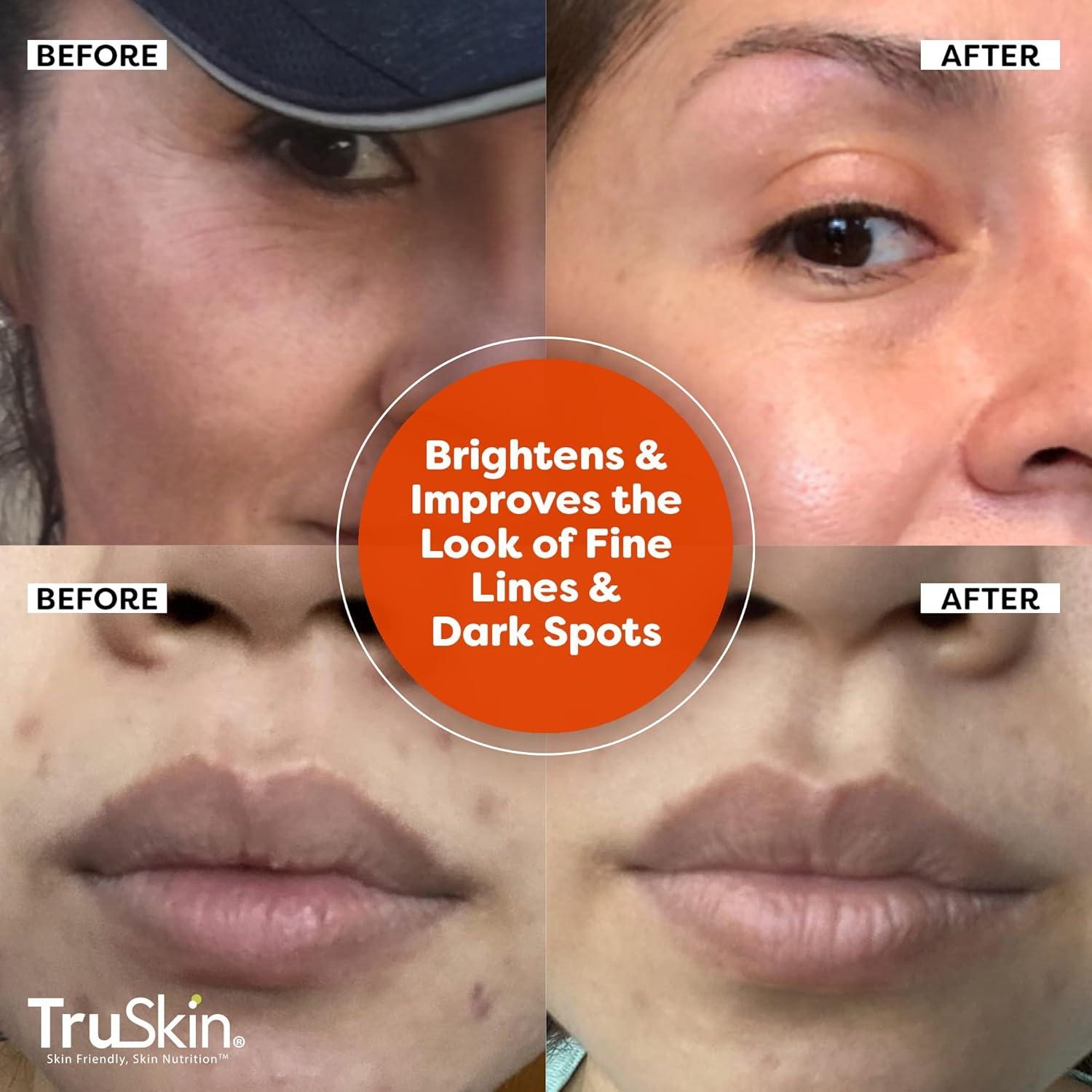 Suero de Vitamina C TruSkin 60 ml - Antienvejecimiento