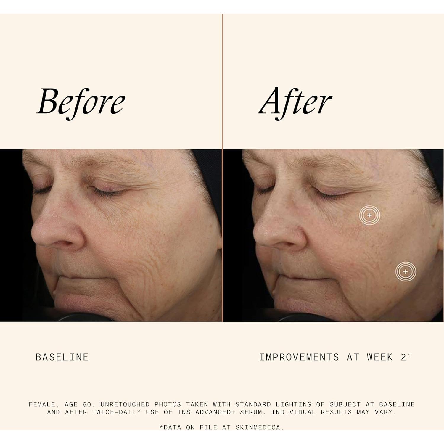 Suero Facial Antienvejecimiento SkinMedica TNS Advanced+ 28g