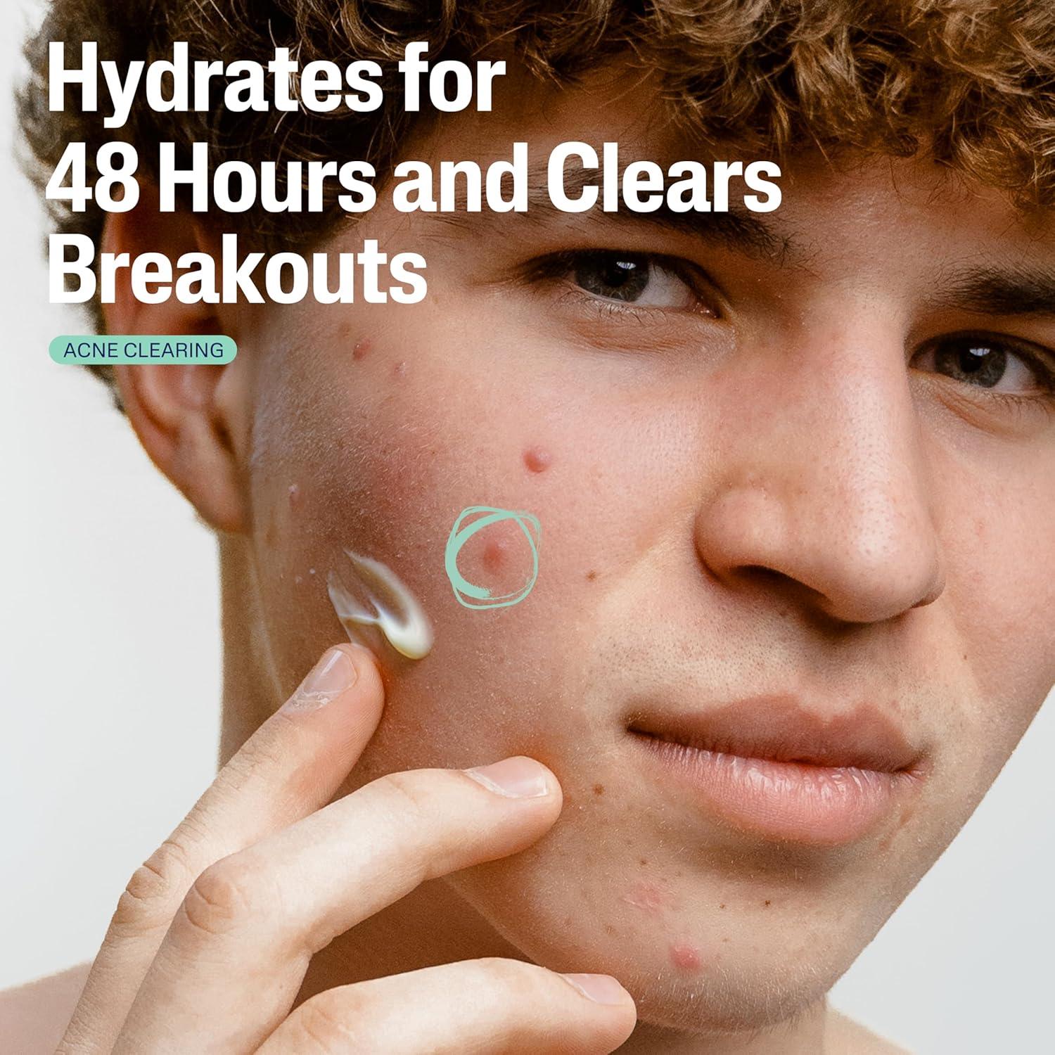 Hidratante Facial Cetaphil 85 g Matificante para Acné