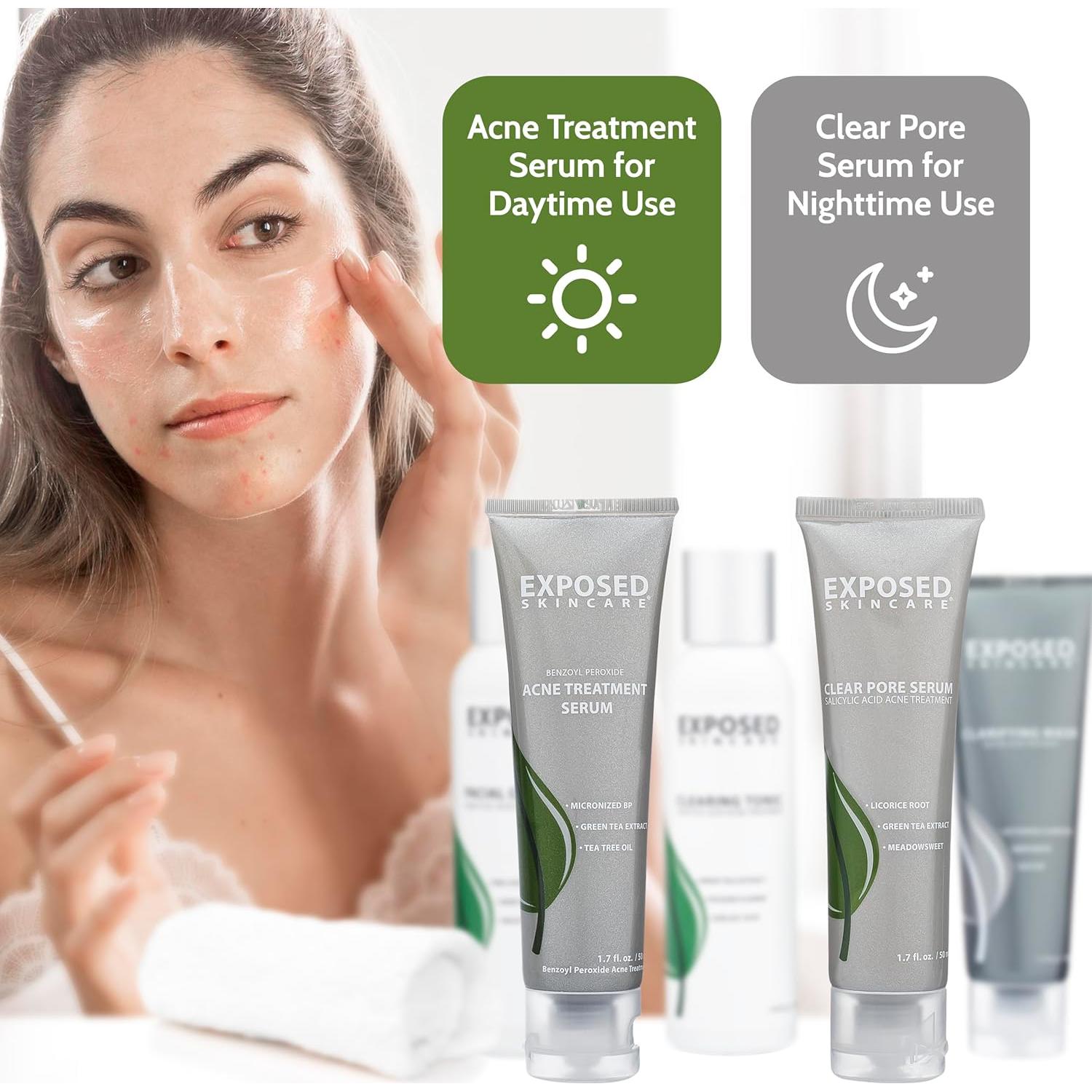 Kit Tratamiento Acné Exposed Skin Care - 5 Piezas Efectivas